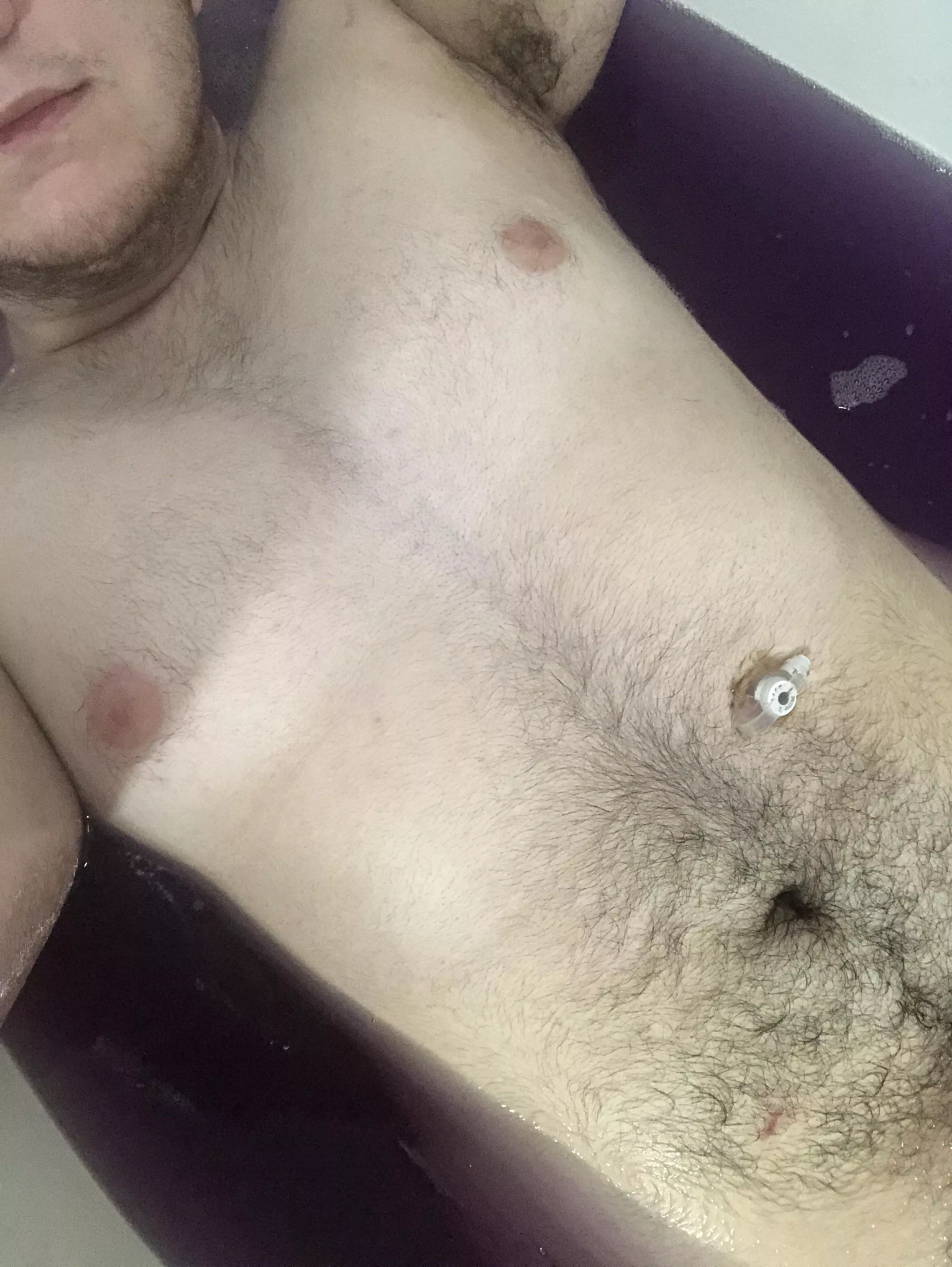 18FTM 5’9” 163lbs. First time posting, just enjoying the bath and this photo almost makes it look like ive had top surgery!