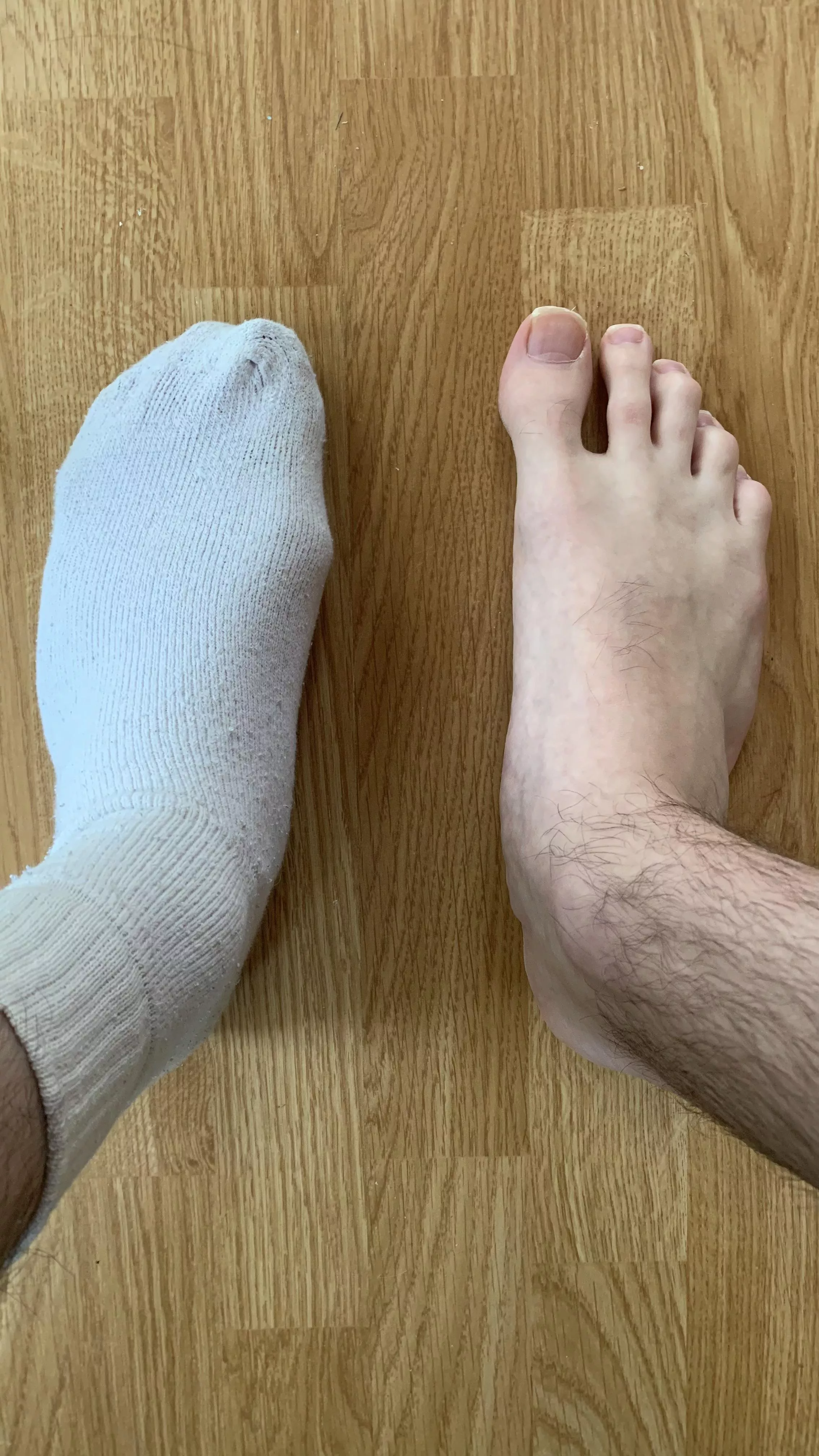 (19) Anyone here like size 11 flat feet 🦶?