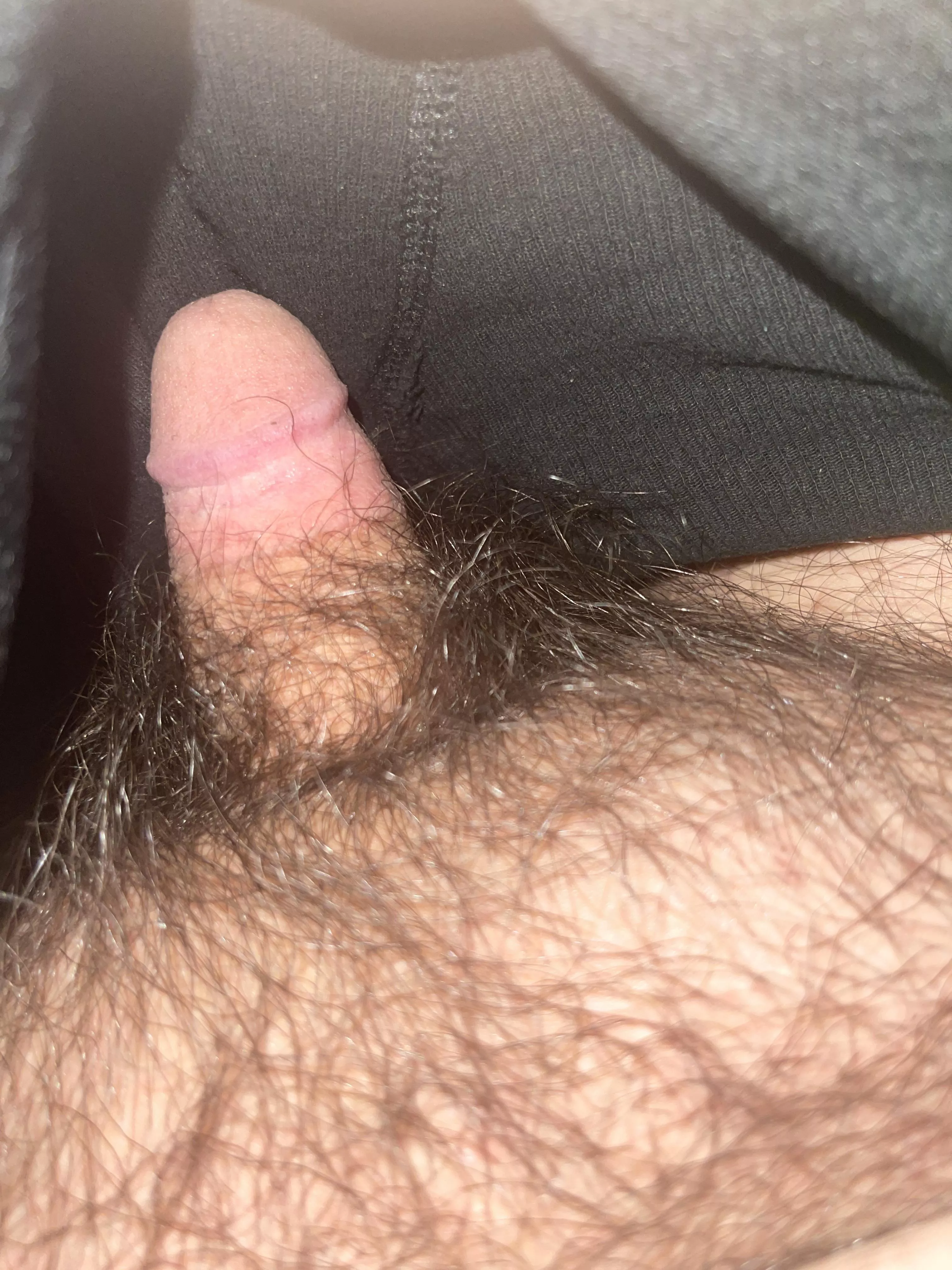 [20] should I shave ? I’ll post more pics if I do