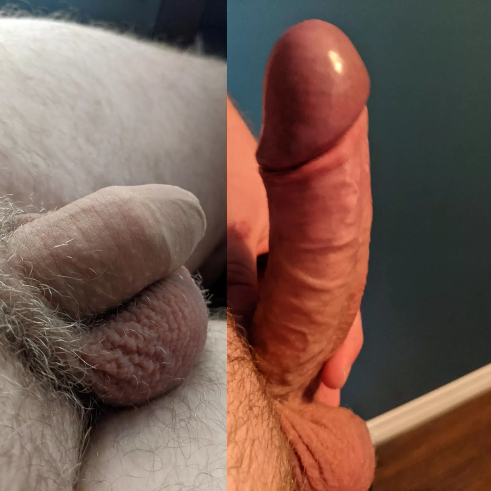 22 Canadian guy here. He's hard for the pic but I'd rather be hard for you 😜 (Kik: DanBaked)