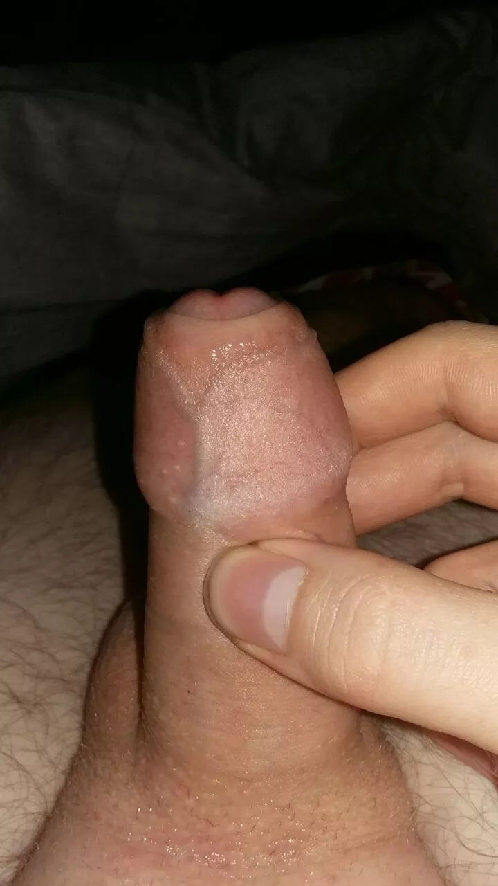 [25] What would you do if you saw this little guy?