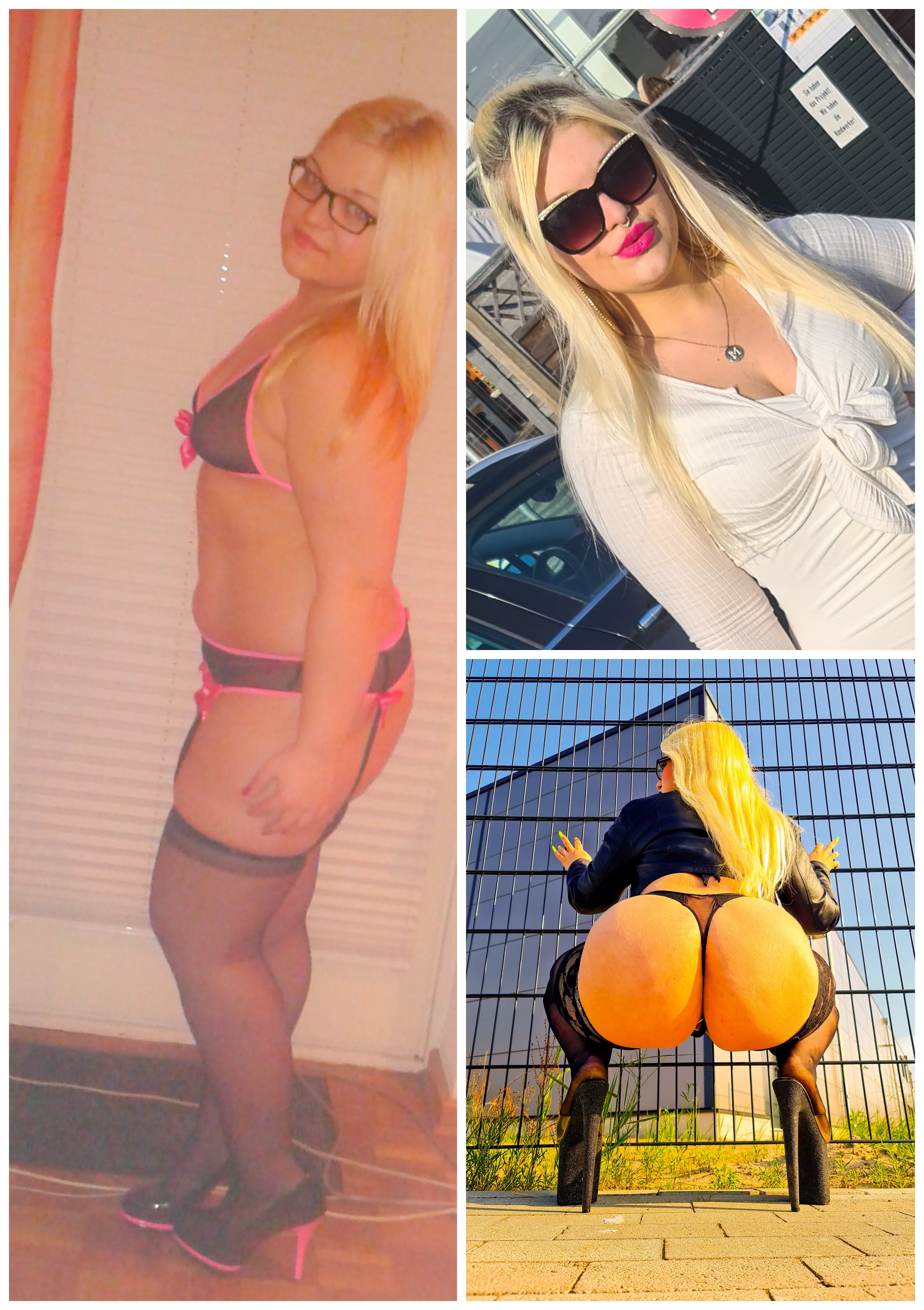 3 Years ago vs Today ðŸ˜‡ Already Done: Lost some weight - BBL ðŸ‘ - 10ml Lips ðŸ’‰ðŸ’‹ and Tits with Body Fat ðŸ˜Š Next Steps: up to 1500cc Breast Implants, more Lipfiller, Botox for Frozen Face ðŸ¥°