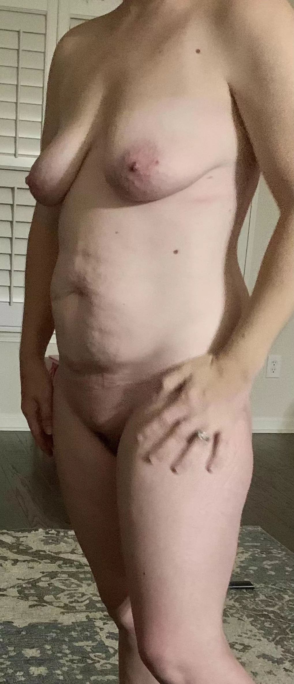 36 F 120 5’. Full frontal