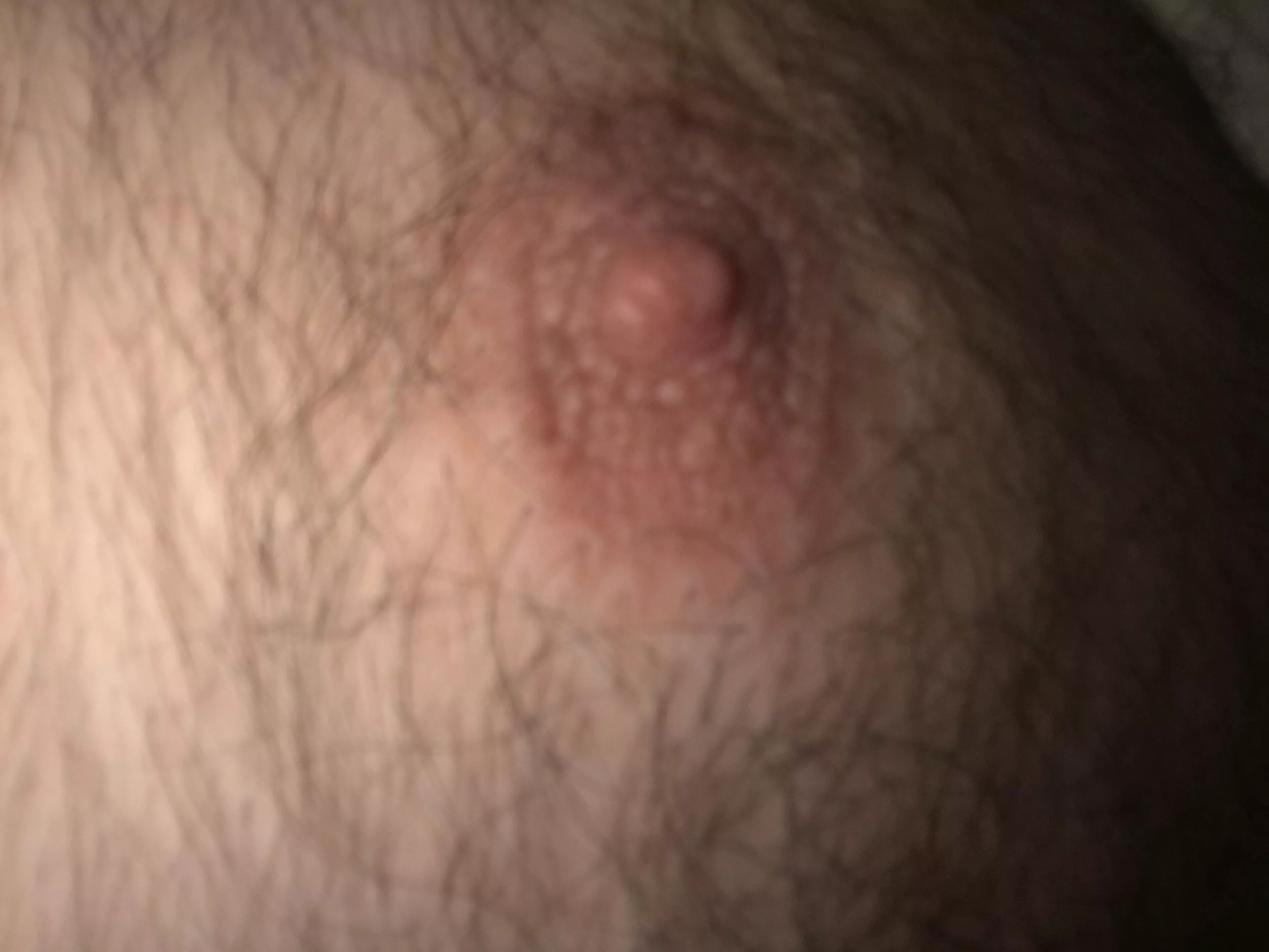 43(m) any ladies care to torture me by biting and sucking my nipples?