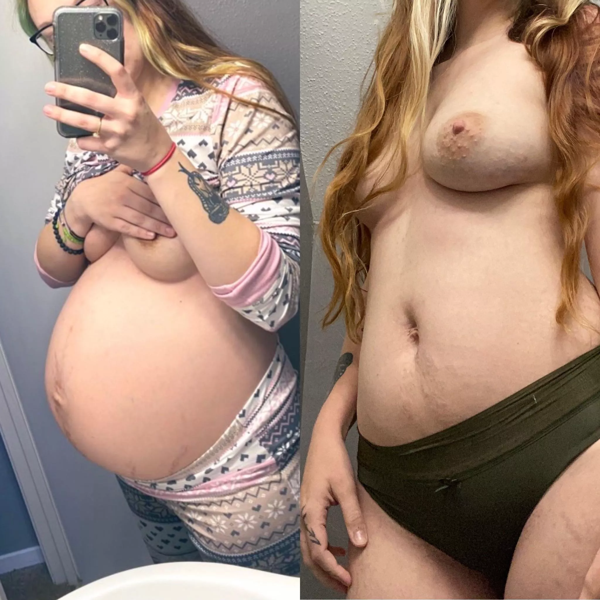 9 months pregnant vs 9 months postpartum. Is it time for another? ðŸ˜†