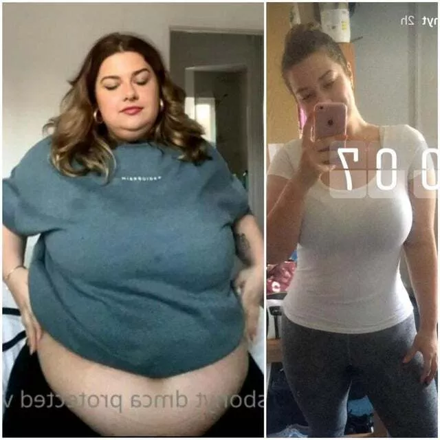 Aliss Bonython's weight gain before and after