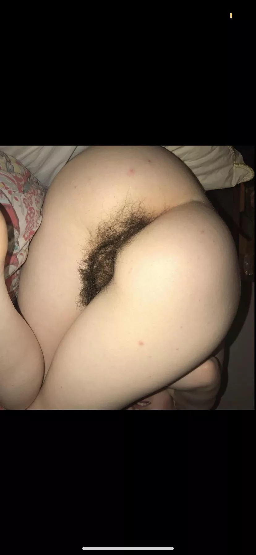 Am I too hairy?