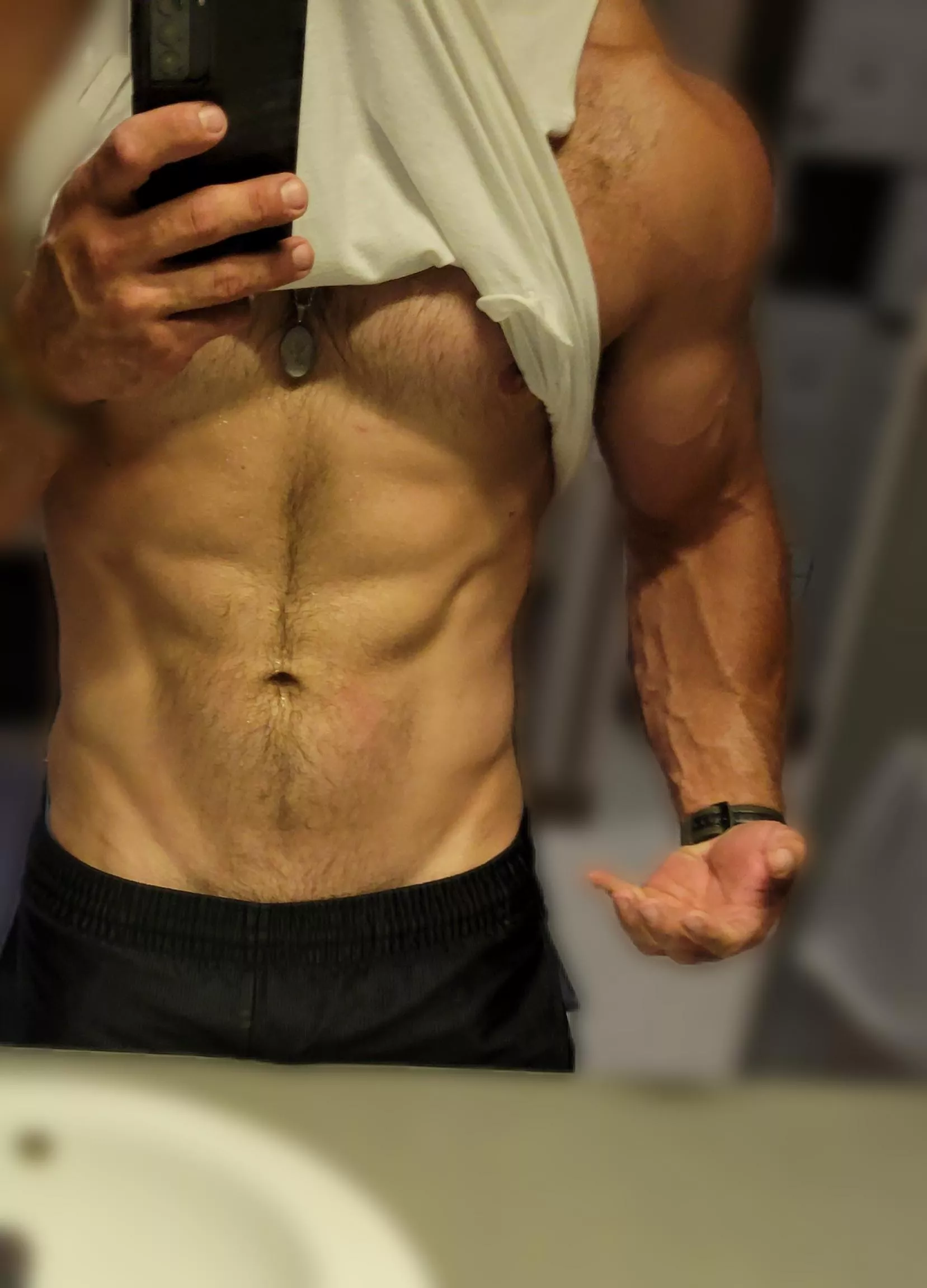 Am I too vascular? [35]