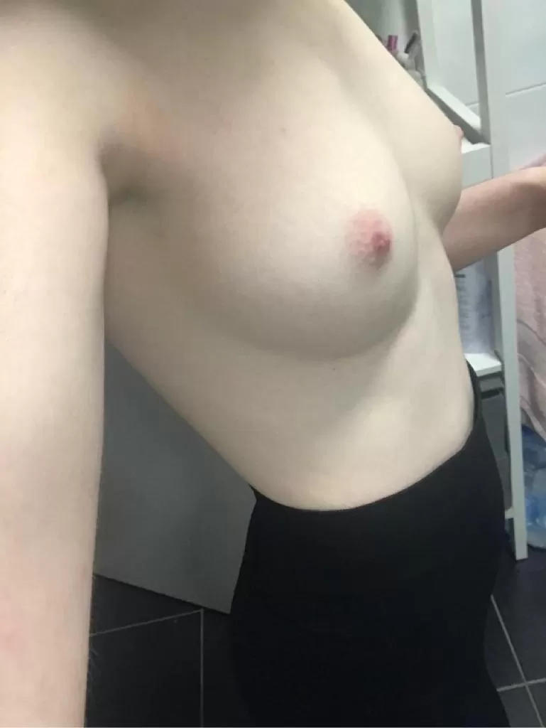 Any pale itty-bitty-titty love here??? ðŸ¥° (F)