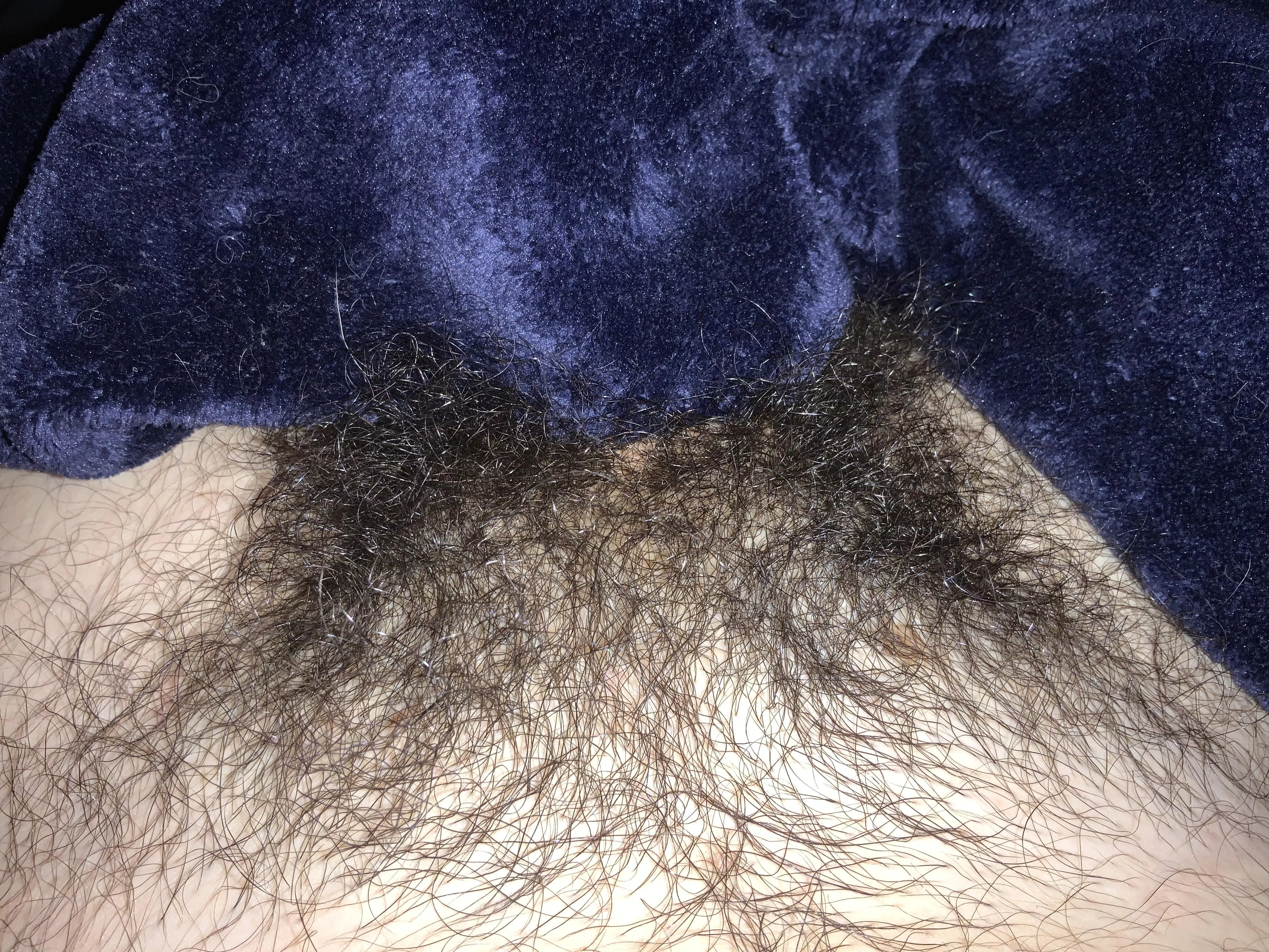 any thoughts on shaving this forest?