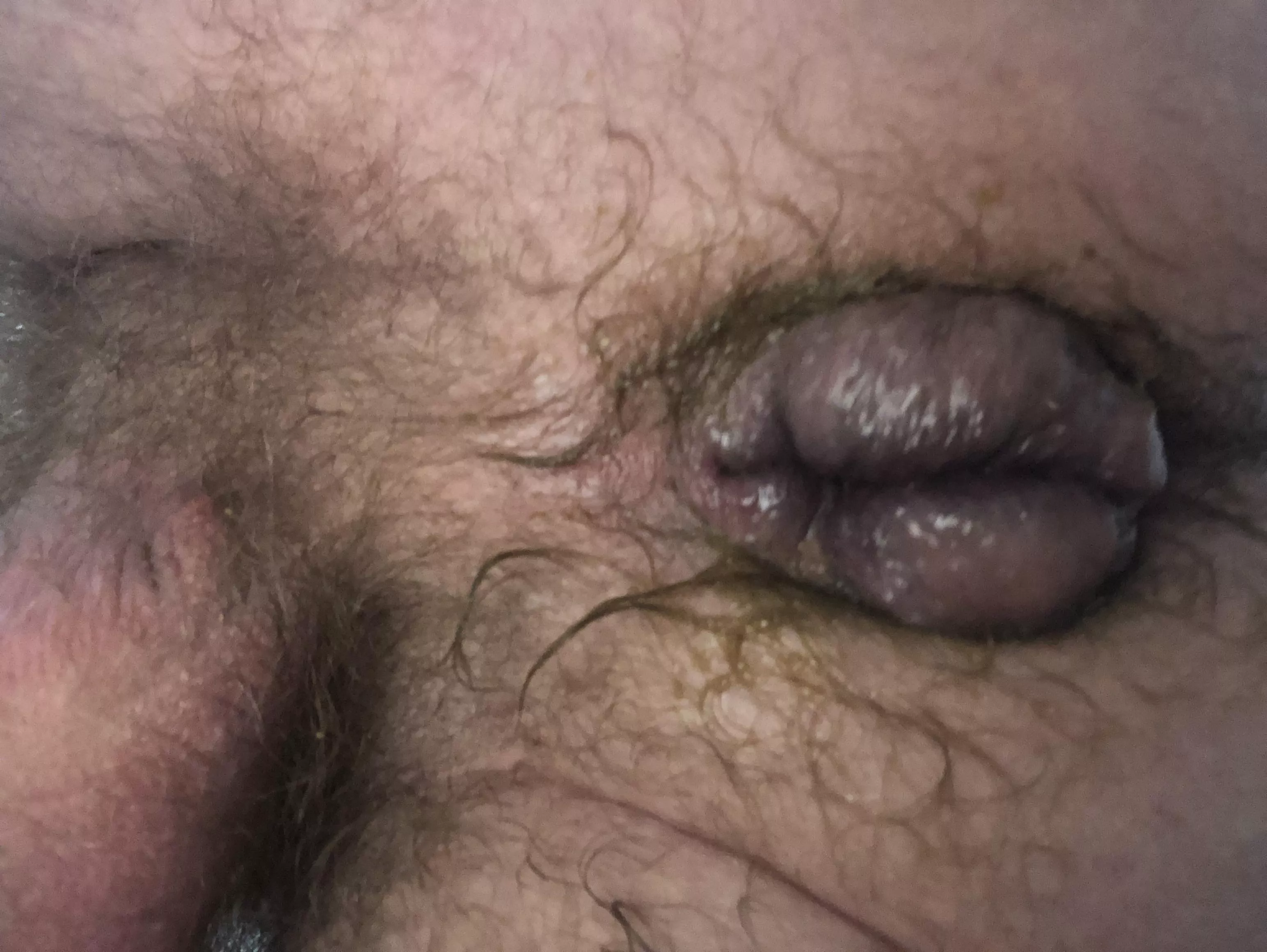 Anybody like swollen holes?