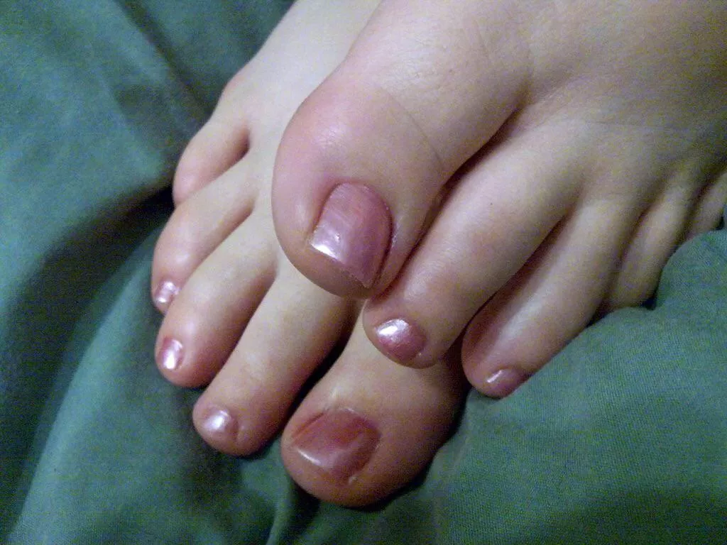 Anyone keen for a serve of my wifeâ€™s sexy little toes? ðŸ˜ðŸ¤¤ðŸ˜‹