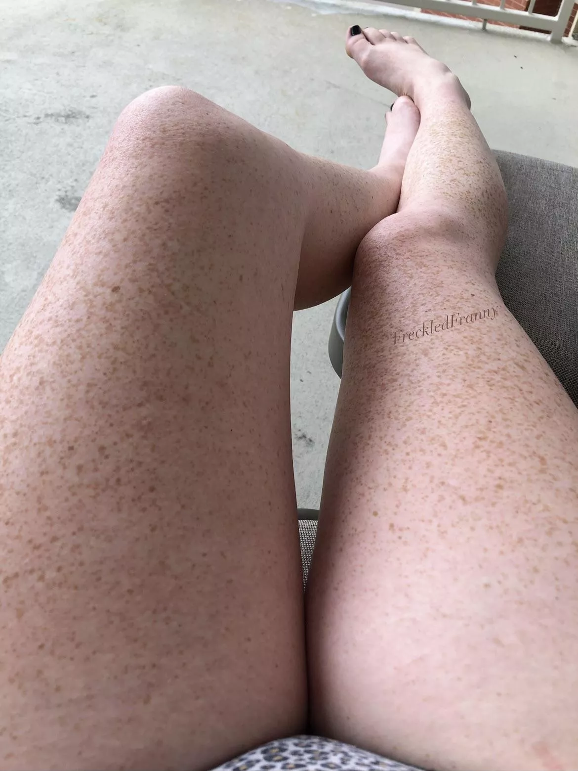 Anyone like my freckled legs?