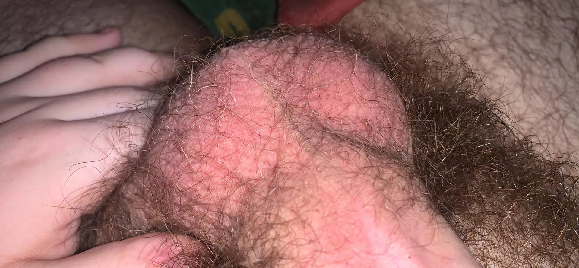 Anyone Like My Hairy Balls?