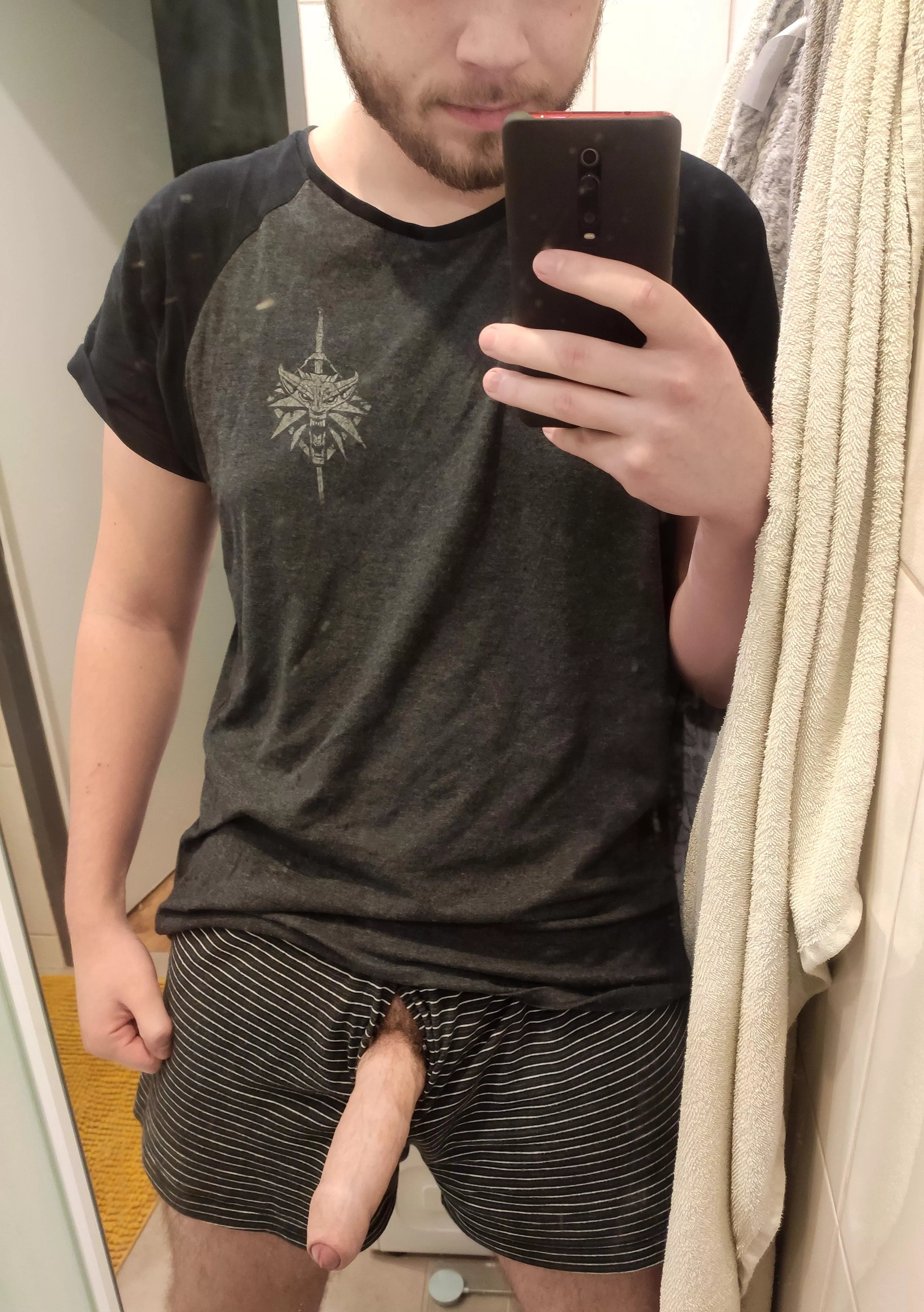 Are uncut boys welcome?