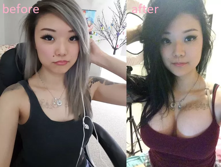 Asian girl buys new boobs!.