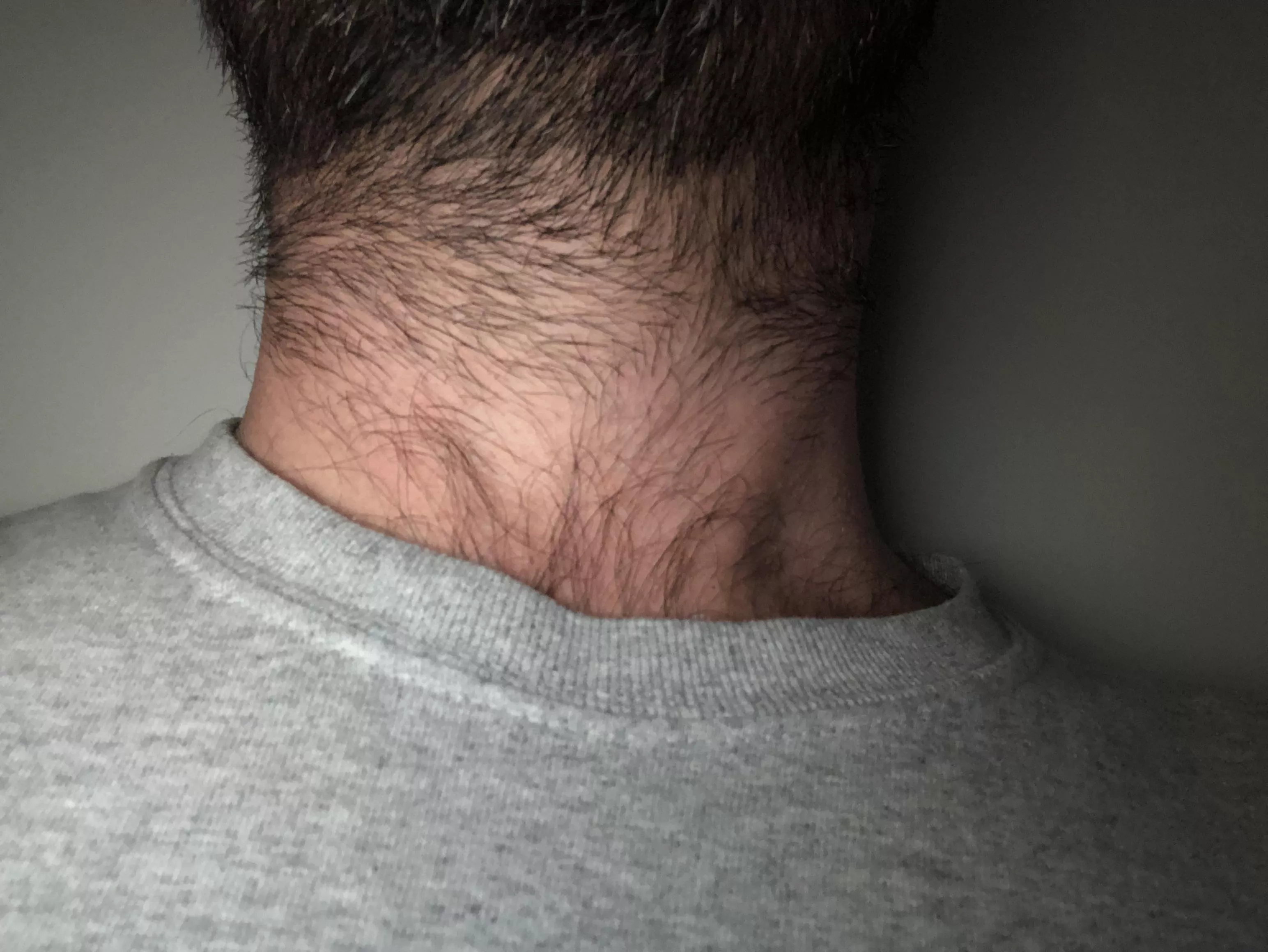 Beard-Chest Hair Connection Almost Complete