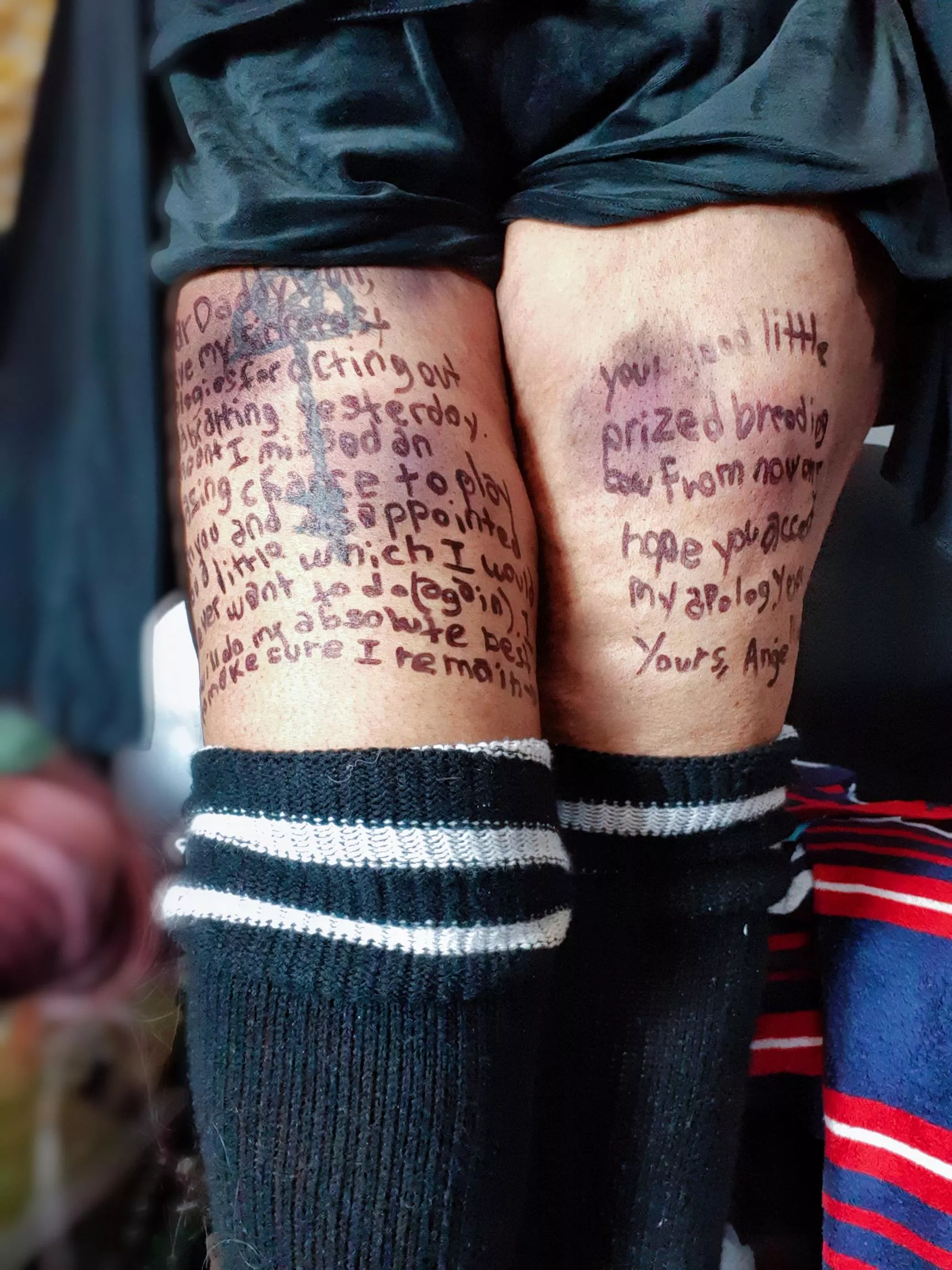 Bruises and body writing go hand in hand ♡