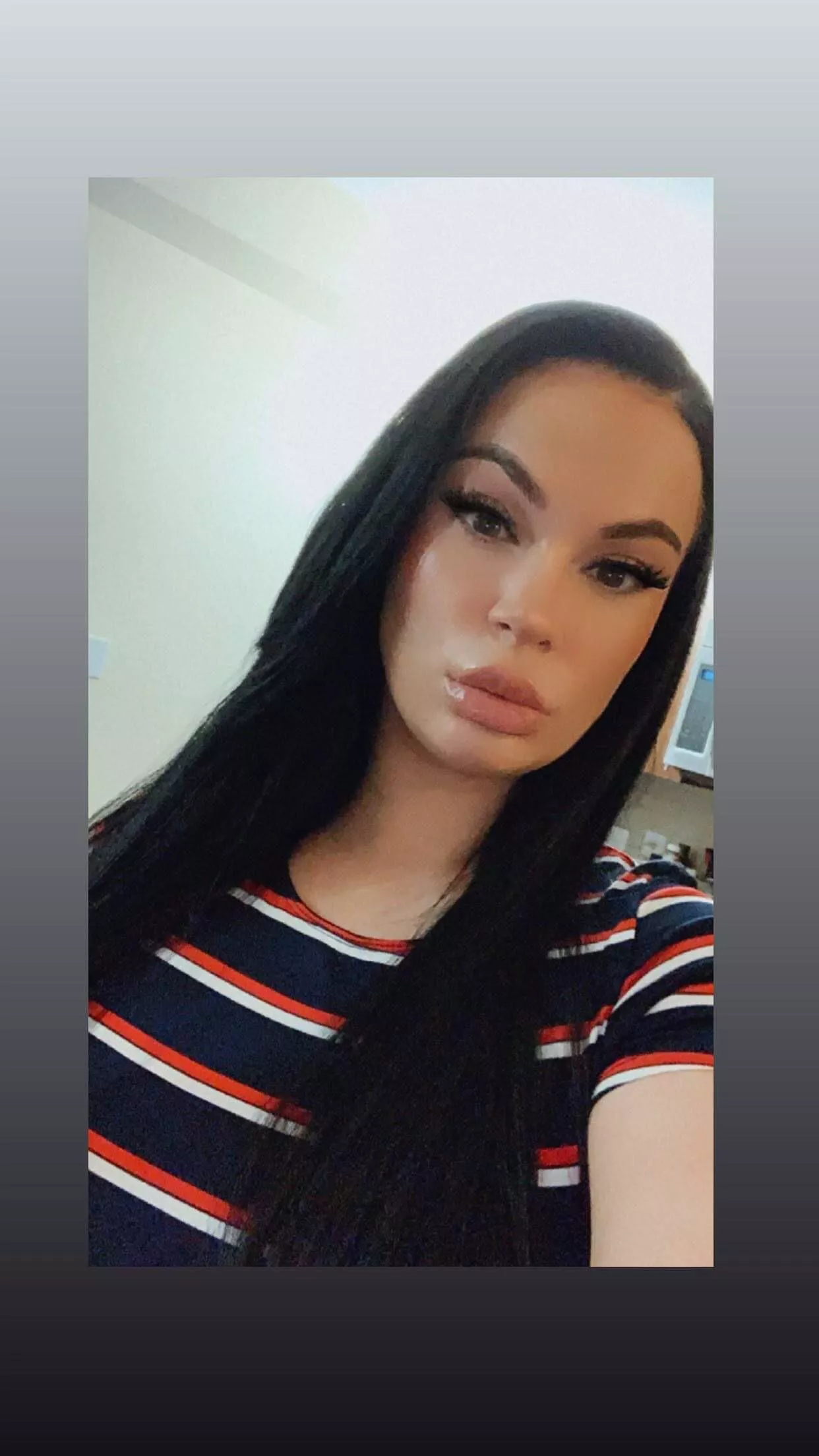 Brunette with lovely lip fillers. How old does she look?