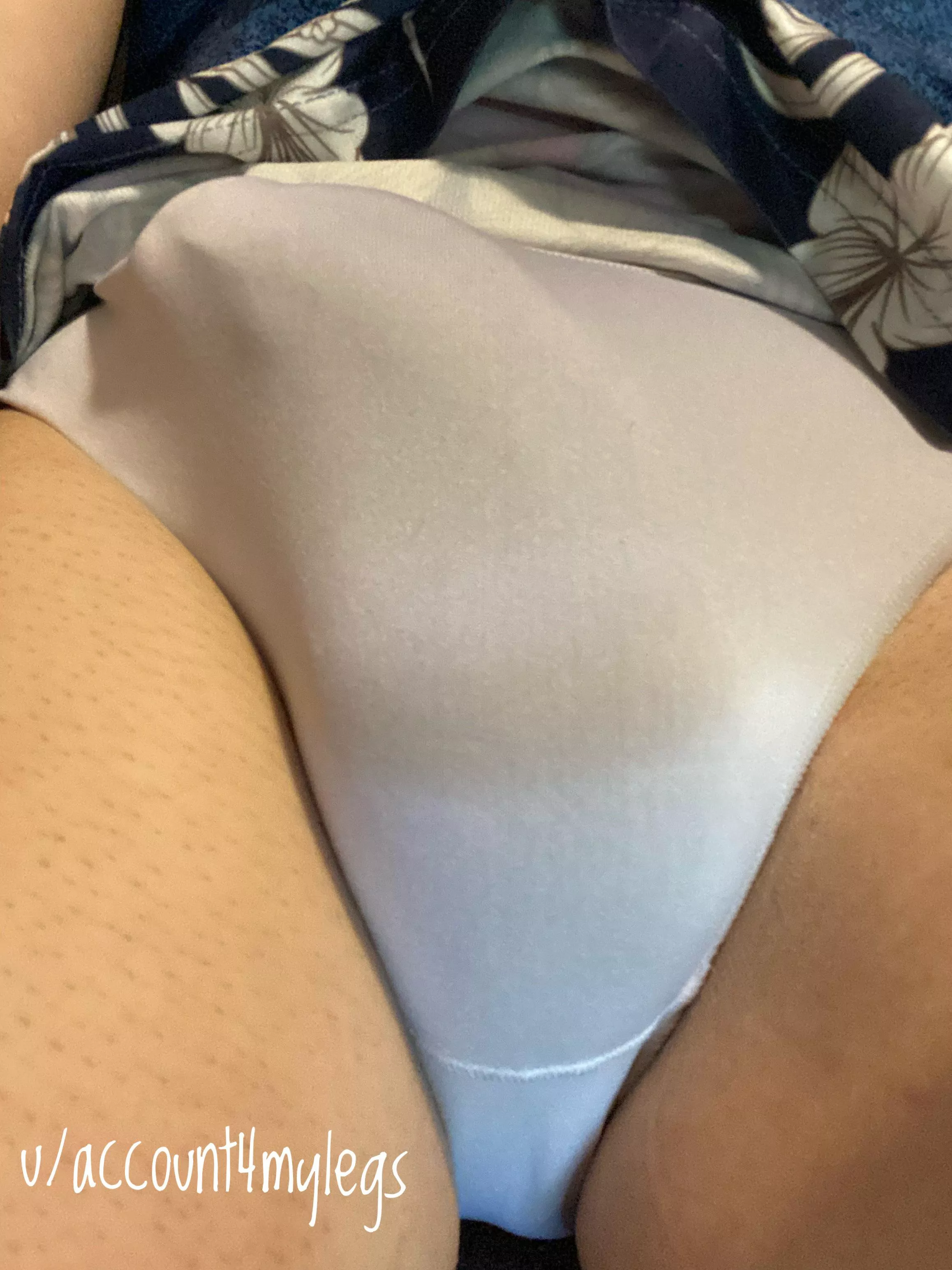 Bulging in white