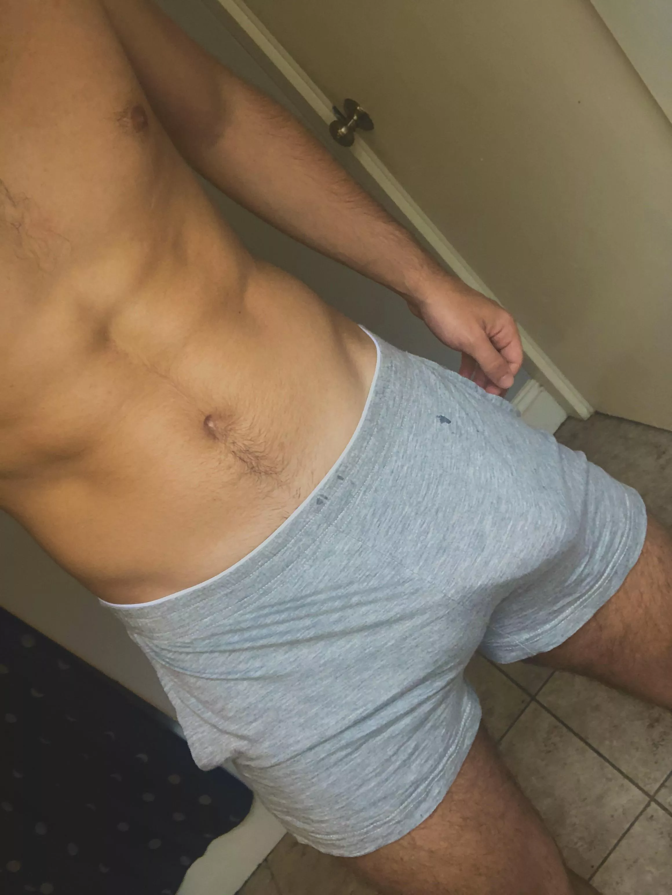 Bulging out (24 years old)