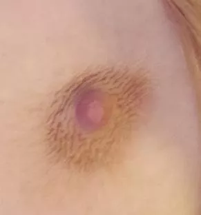 Closeup of my cute little wrinkled nipple :)