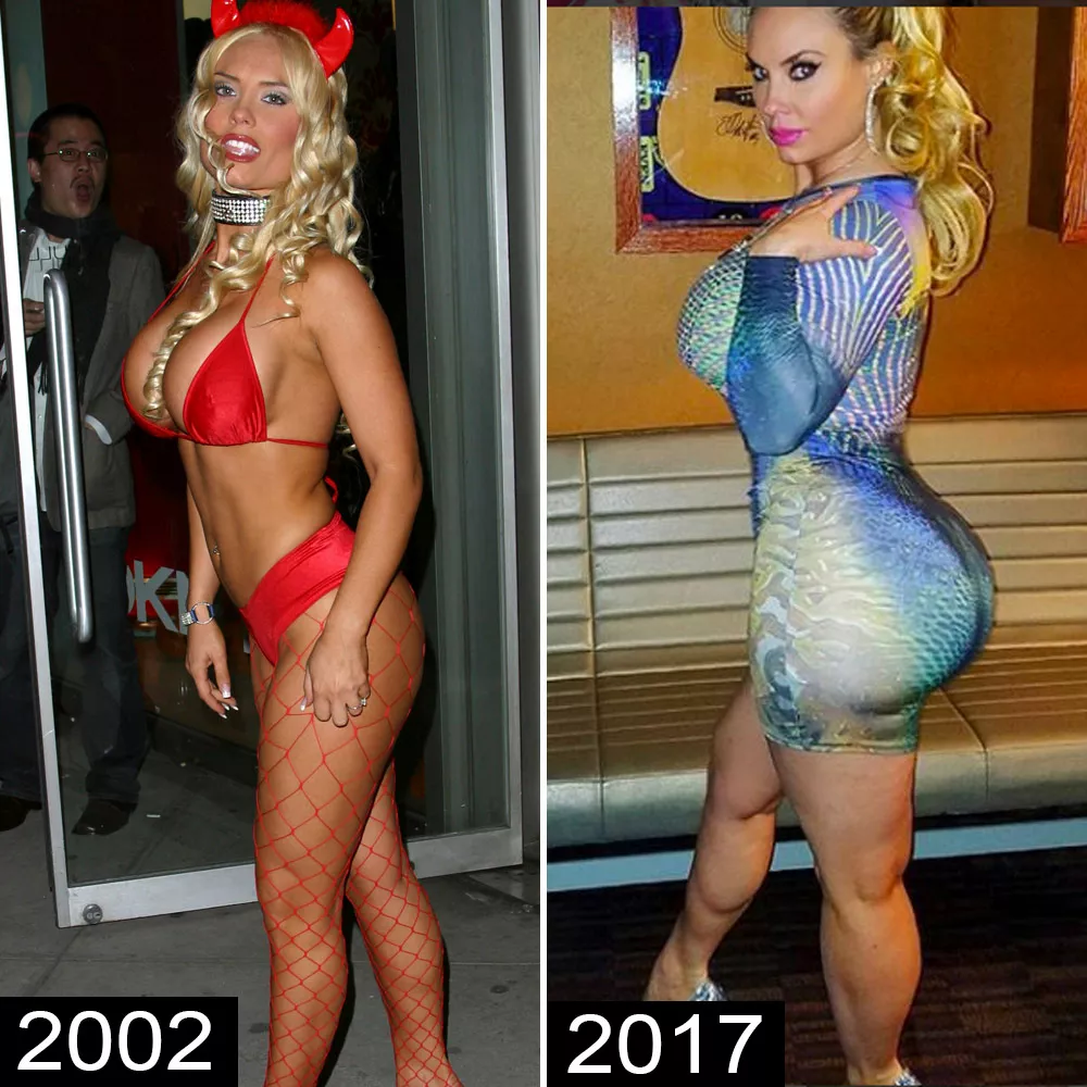 Coco austin butt implants