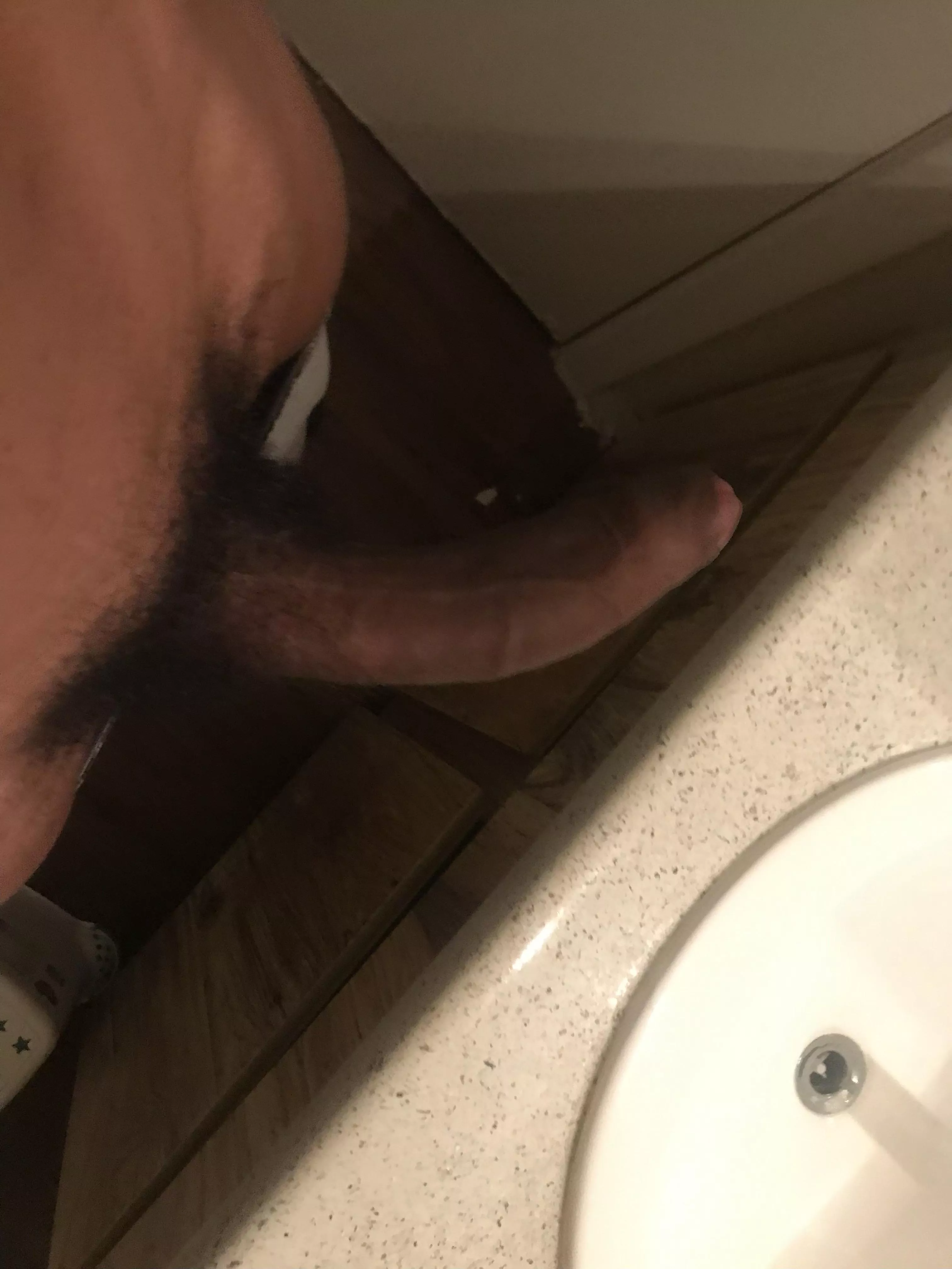 Do you like the way my foreskin looks here?