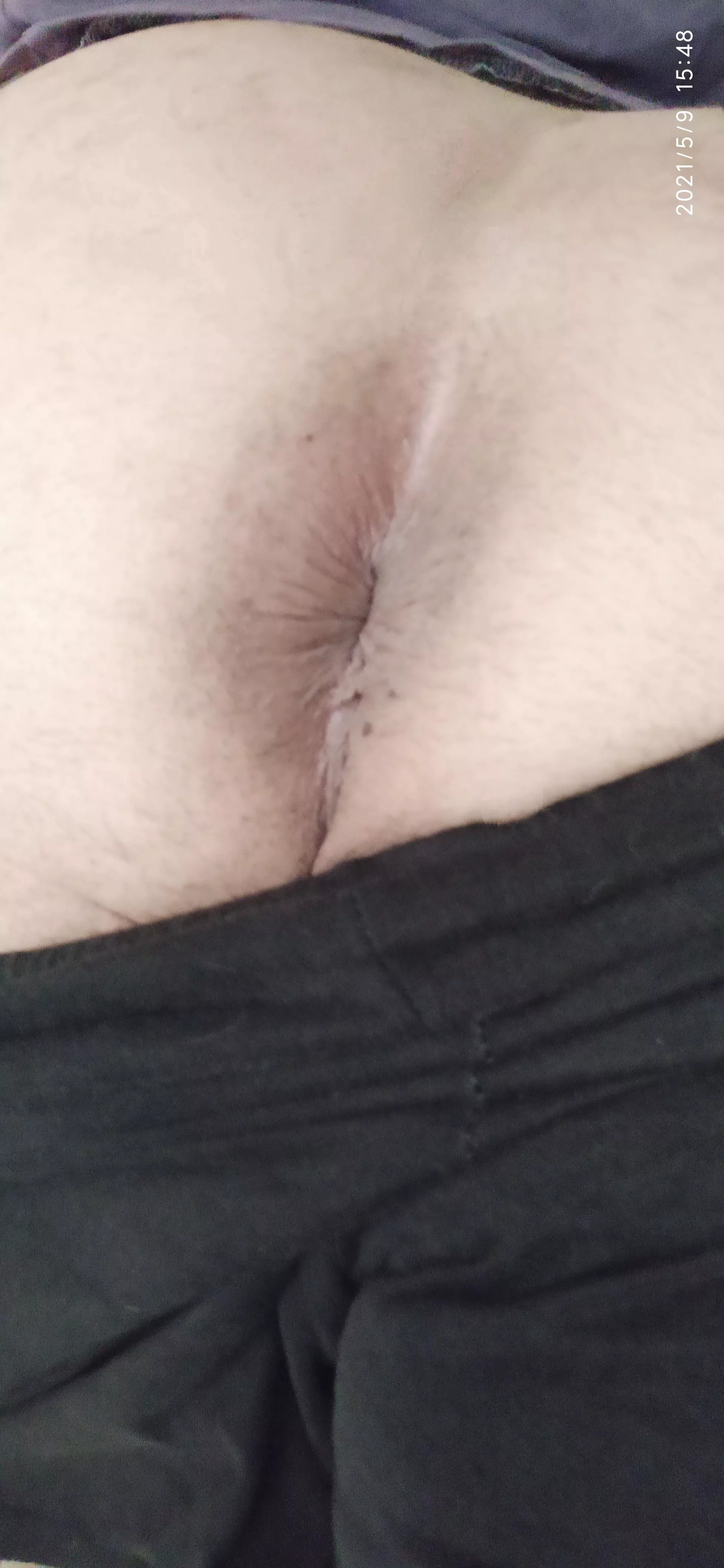 Don't know if its beautiful or sexy. Virgin butthole. Be honest. DM's are always open.