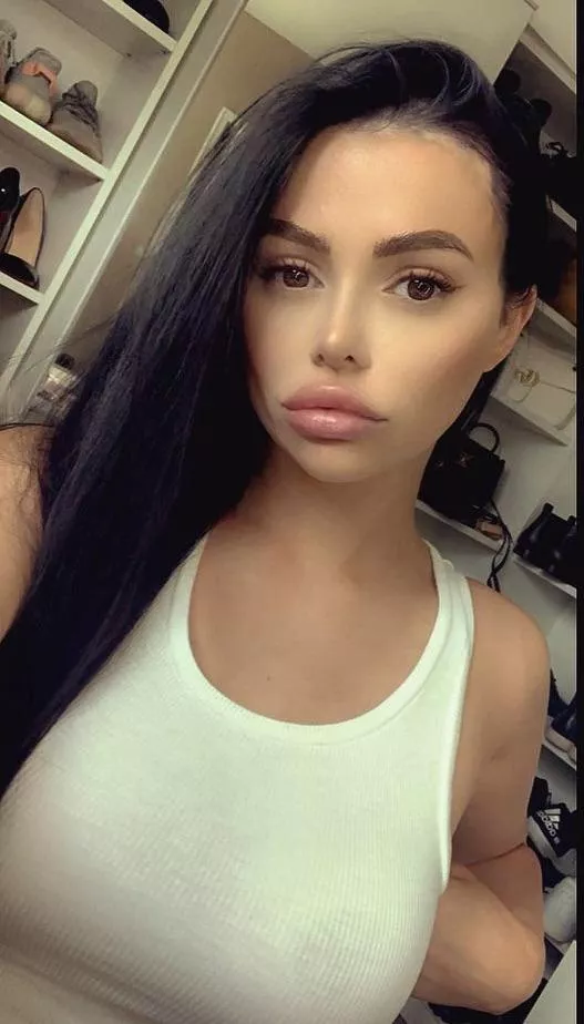 Fake tits and fat lips