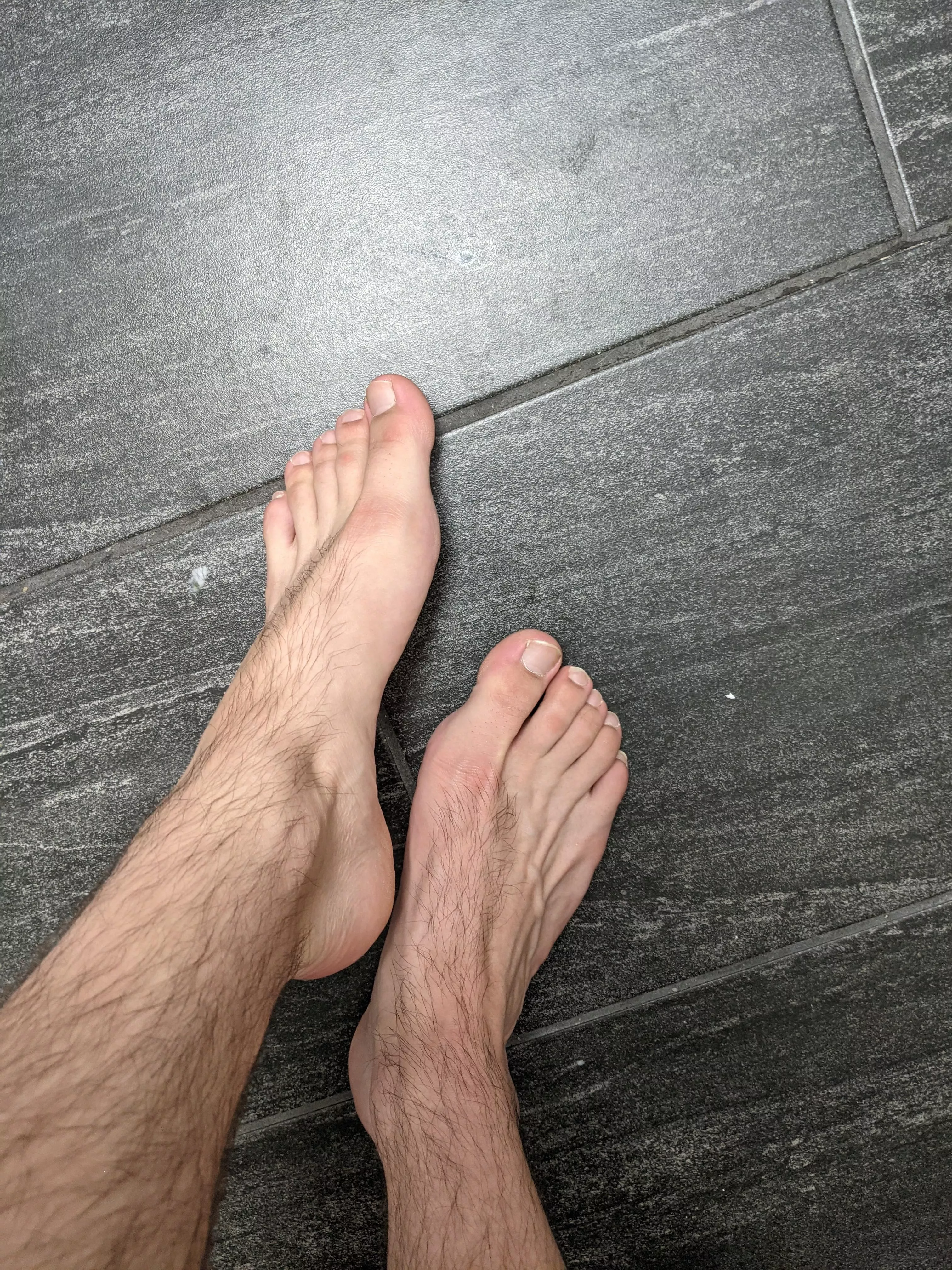 First time posting pics of my feet. What do you think?