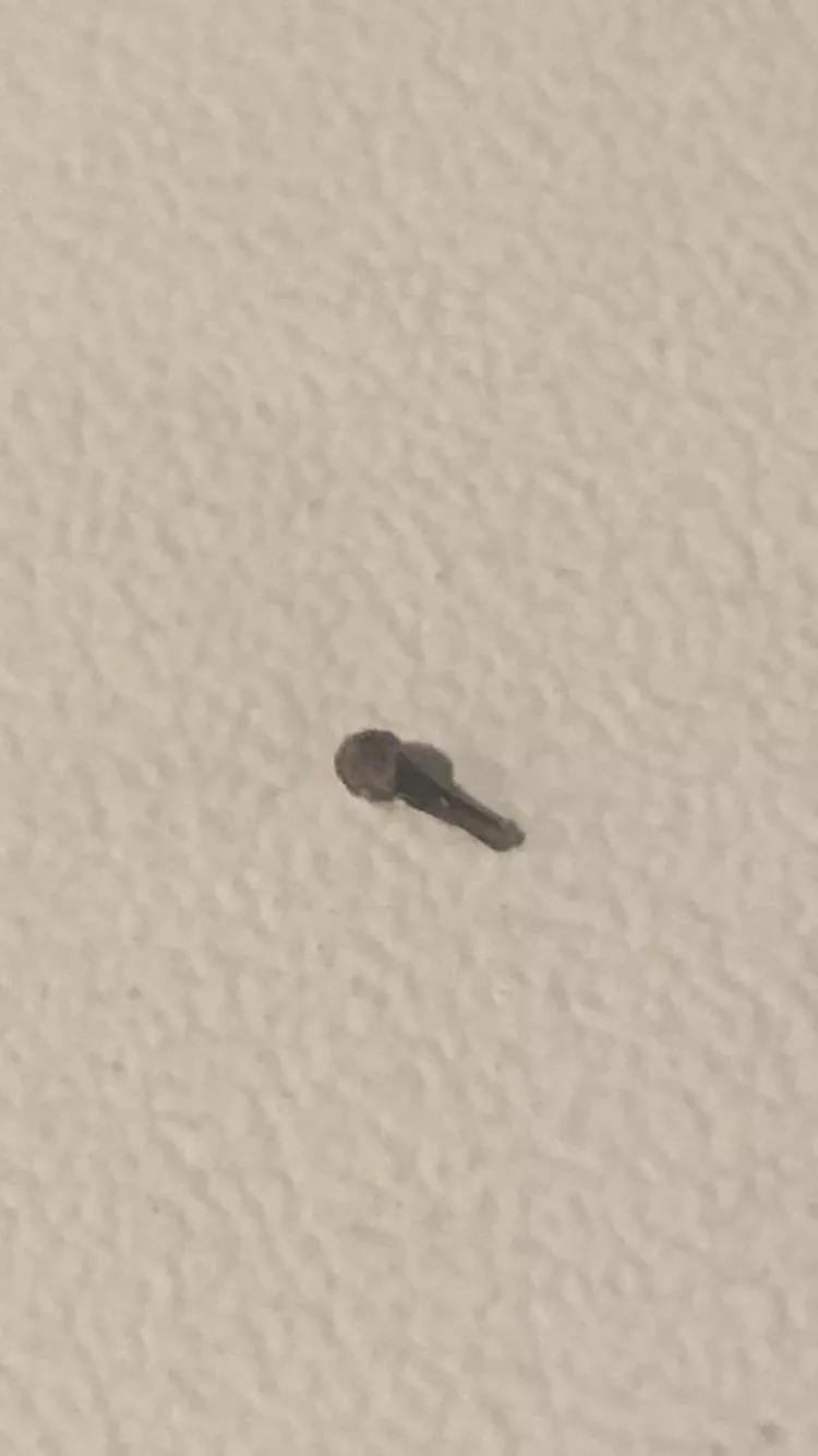 Found this sharp hard thing inside a huge pimple/boil on my neck. What is it?