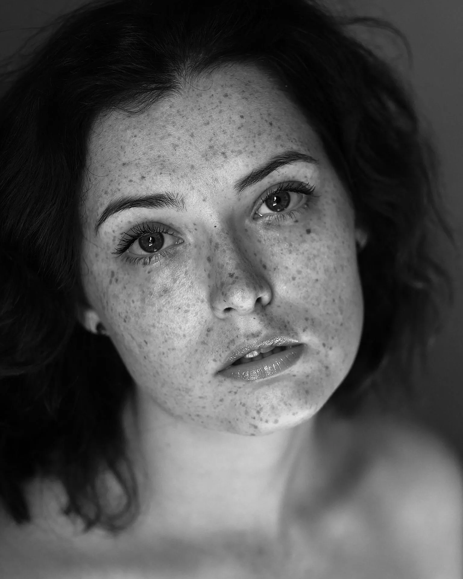 Freckles