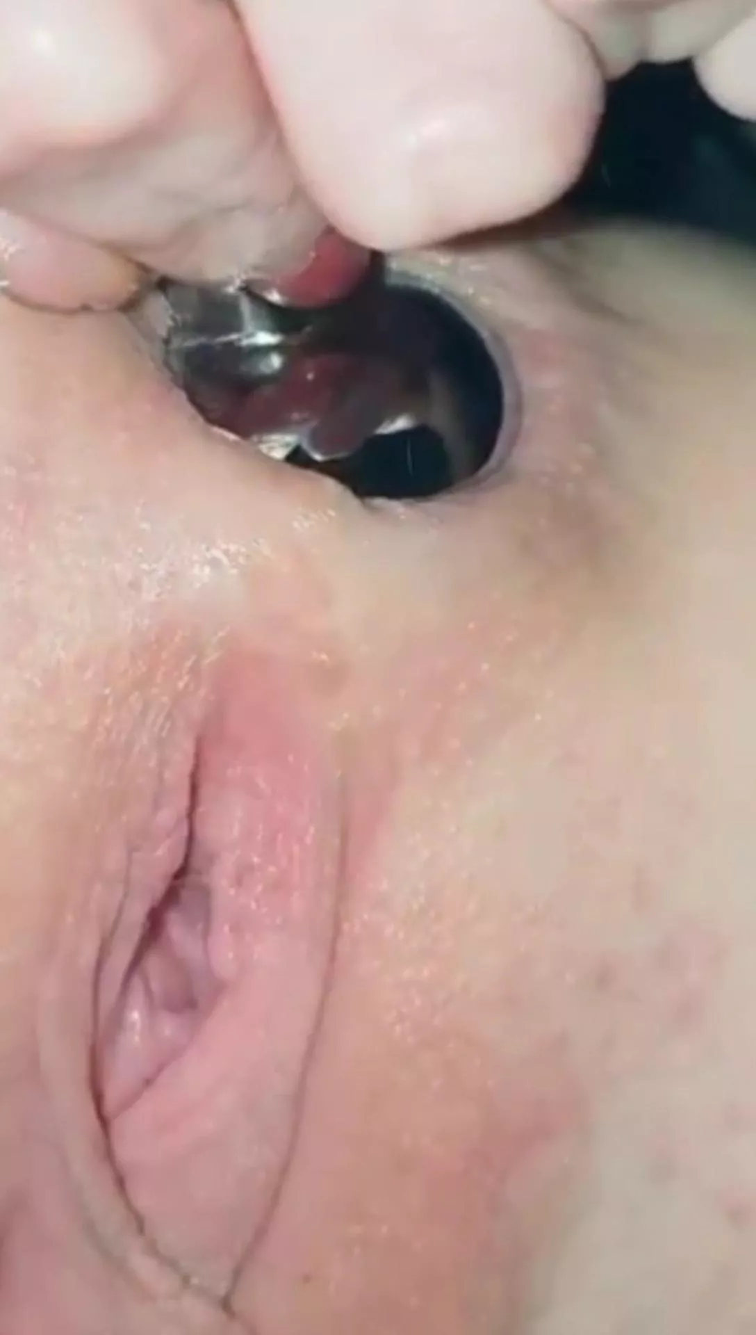 Gape