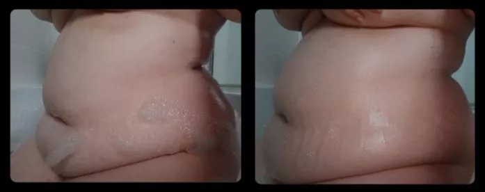 Had this image and video for a while but forgot to upload them! I was gassy and already bloated so added an enema to the mix and recorded the sounds. https://youtu.be/uk2GK5OnZnc