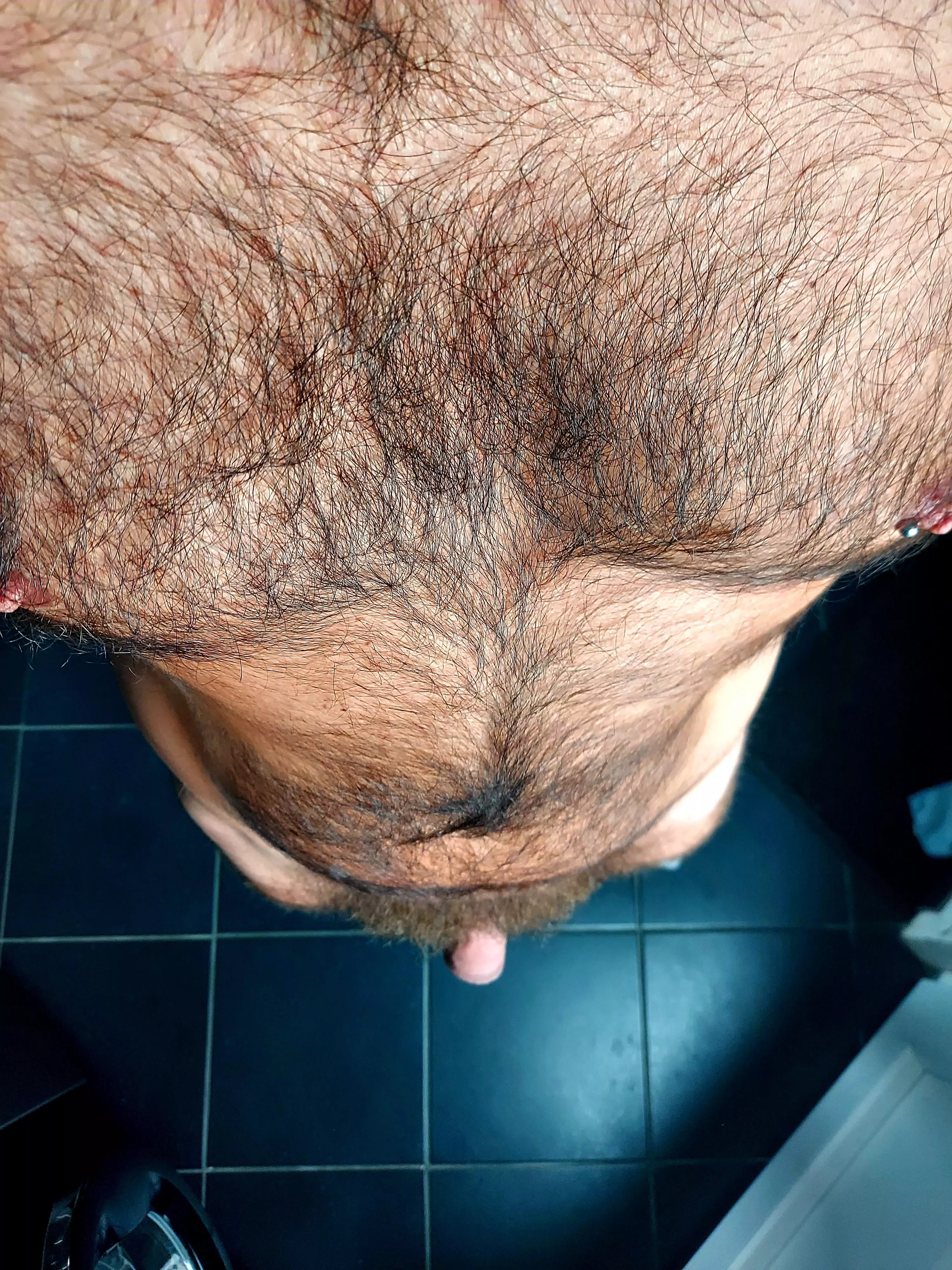 hairy everywhere :)