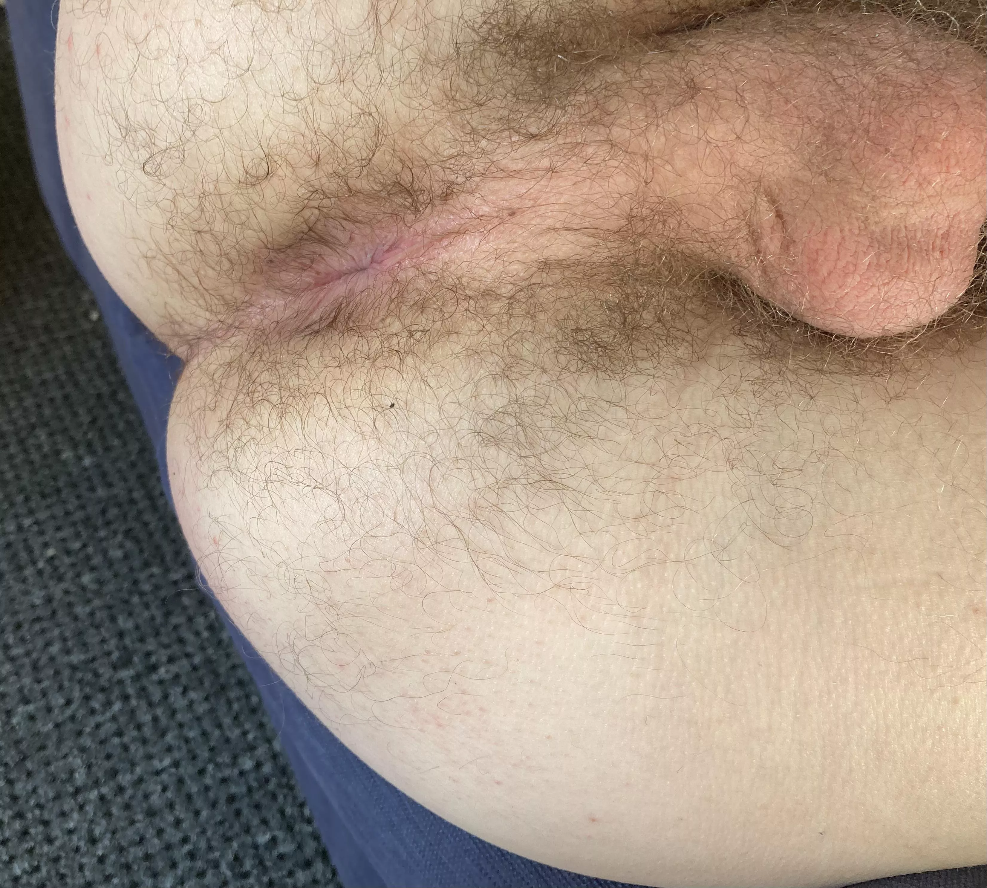 Howâ€™s my hairy taint look? 22M