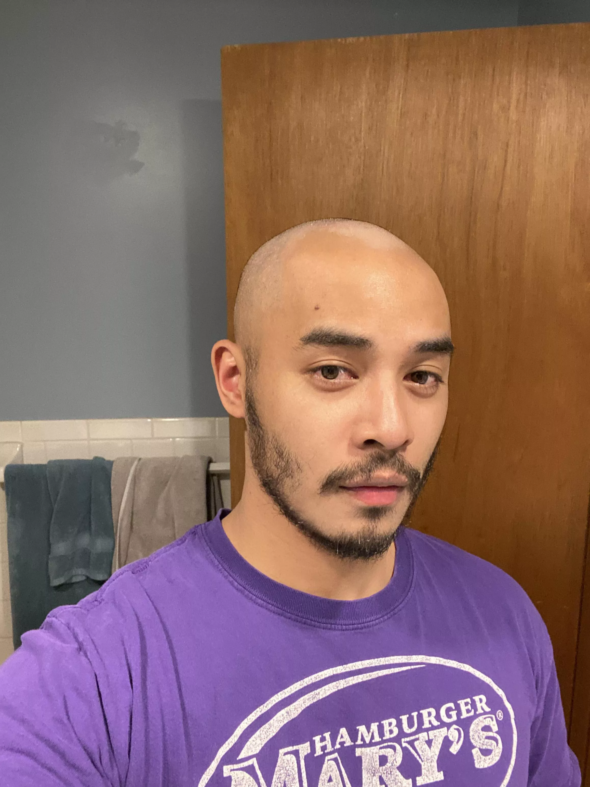 Hows the bald look? Got receding hair hairline…. I just need to own it.