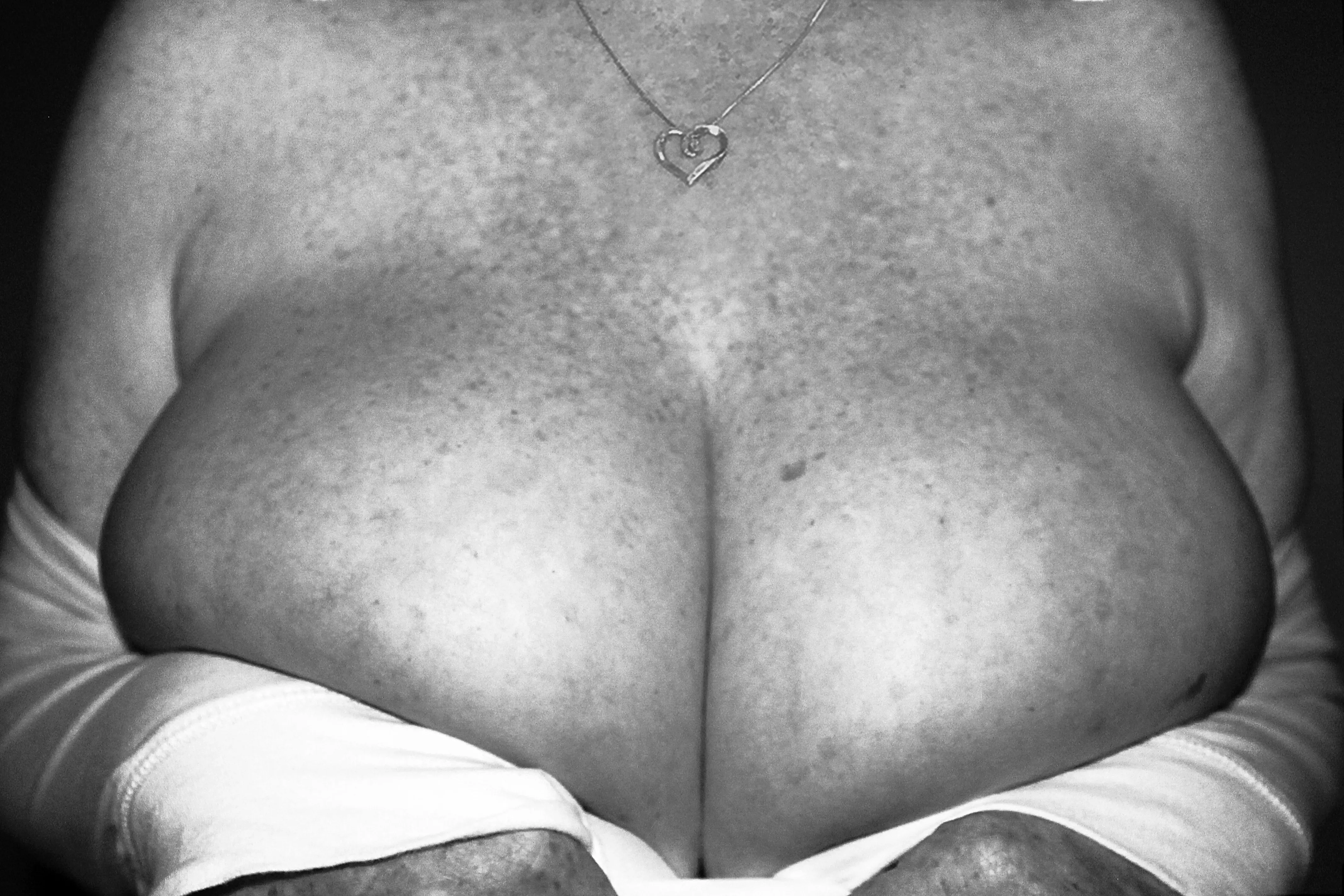 Huge Freckled Boobs in B&W