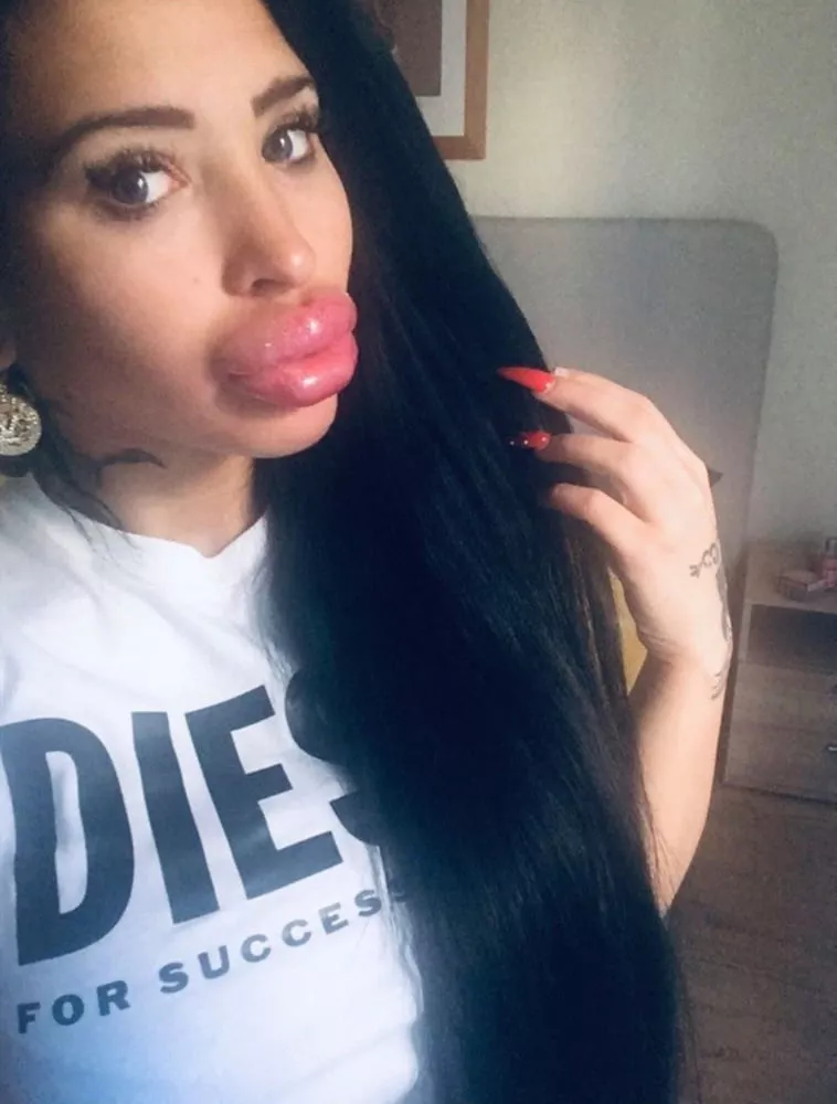 Huge Lips for Success