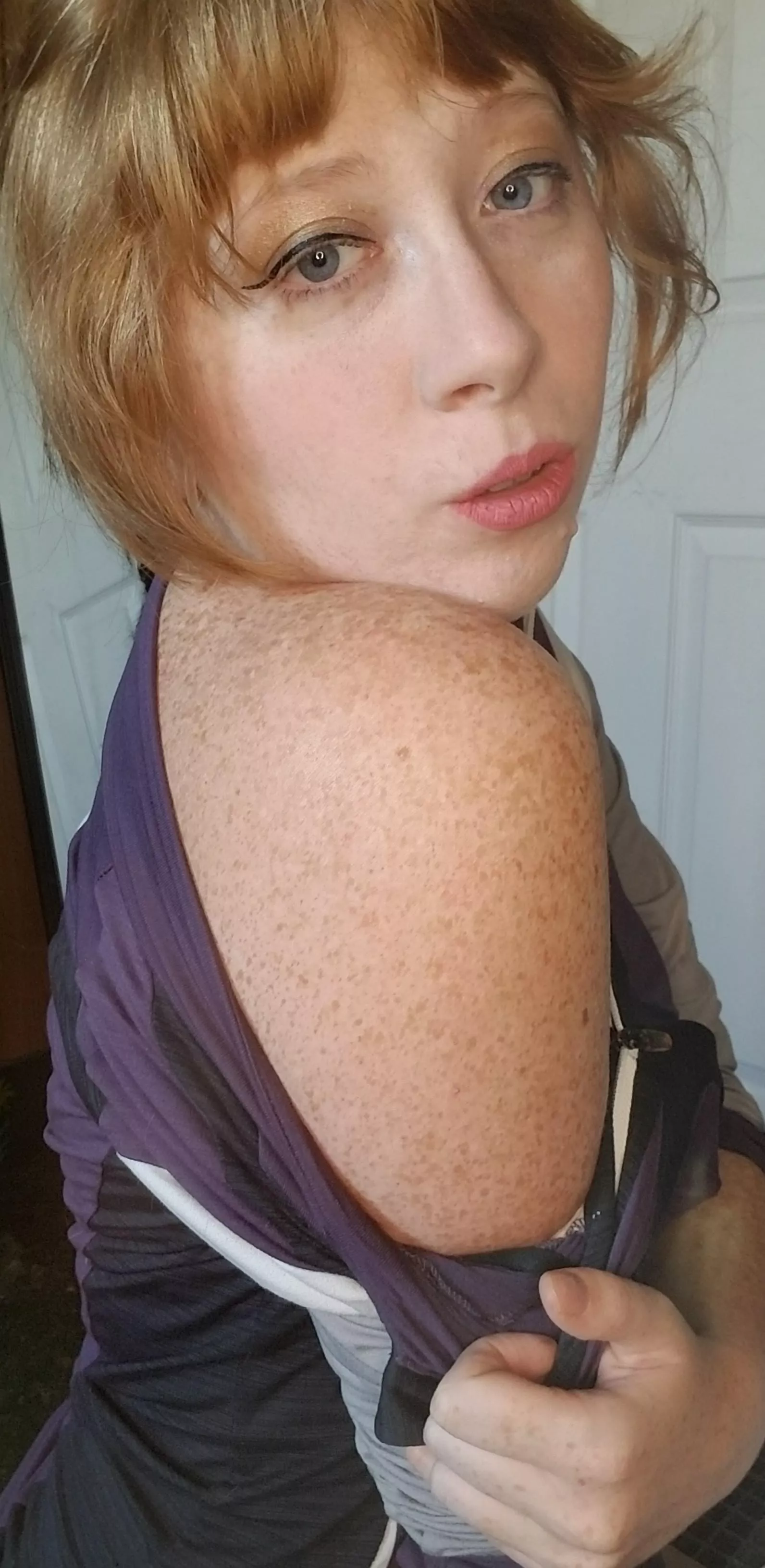 I have so many shoulder freckles :P