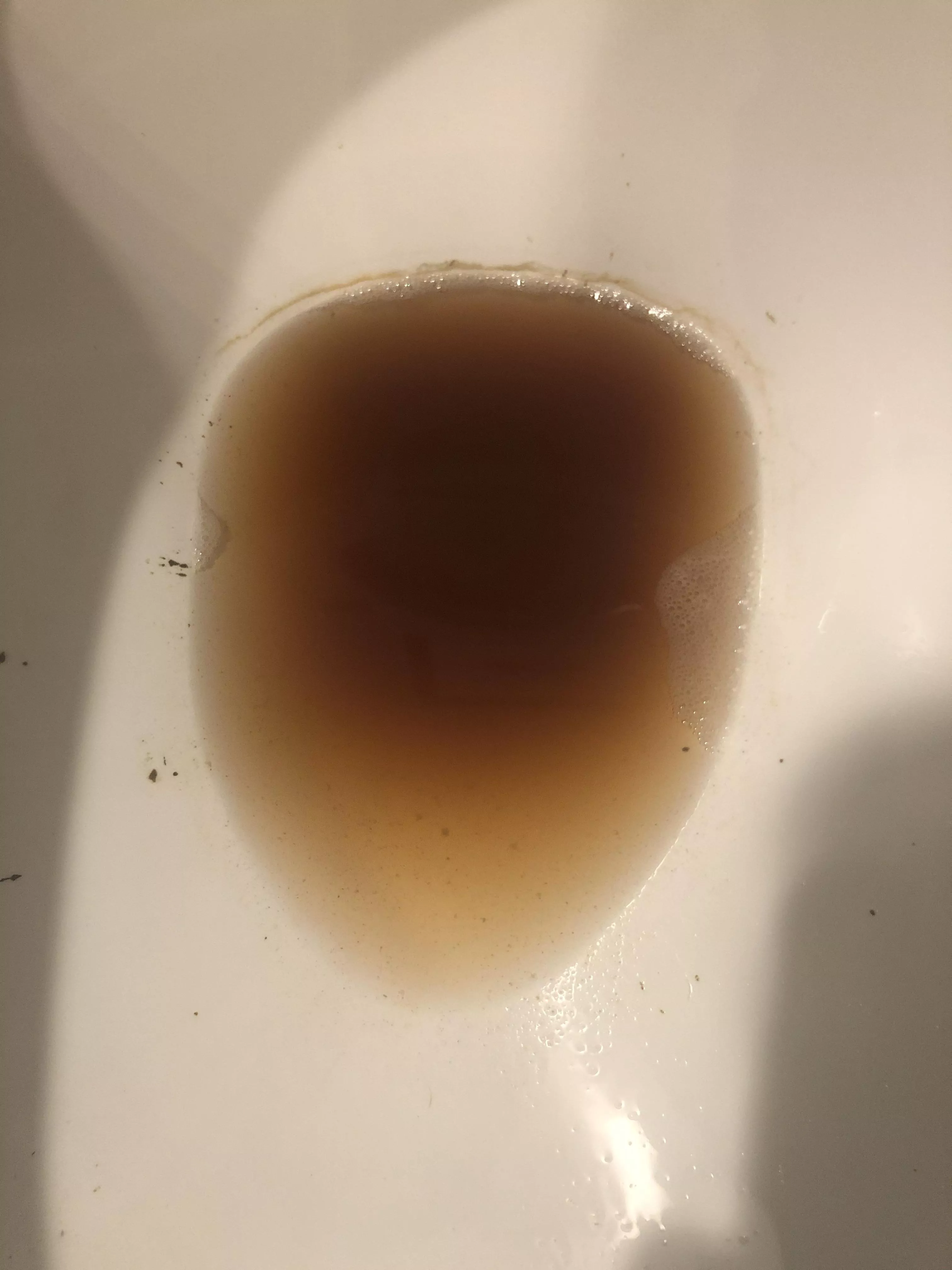 Is it bad that my piss looks like this?