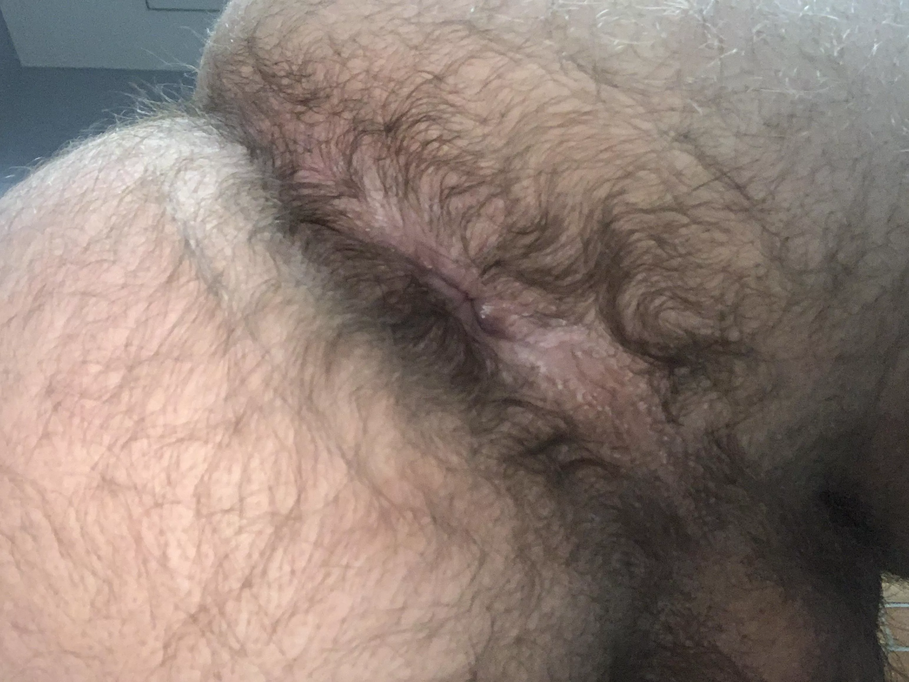 Is this hairy enough for this subreddit?