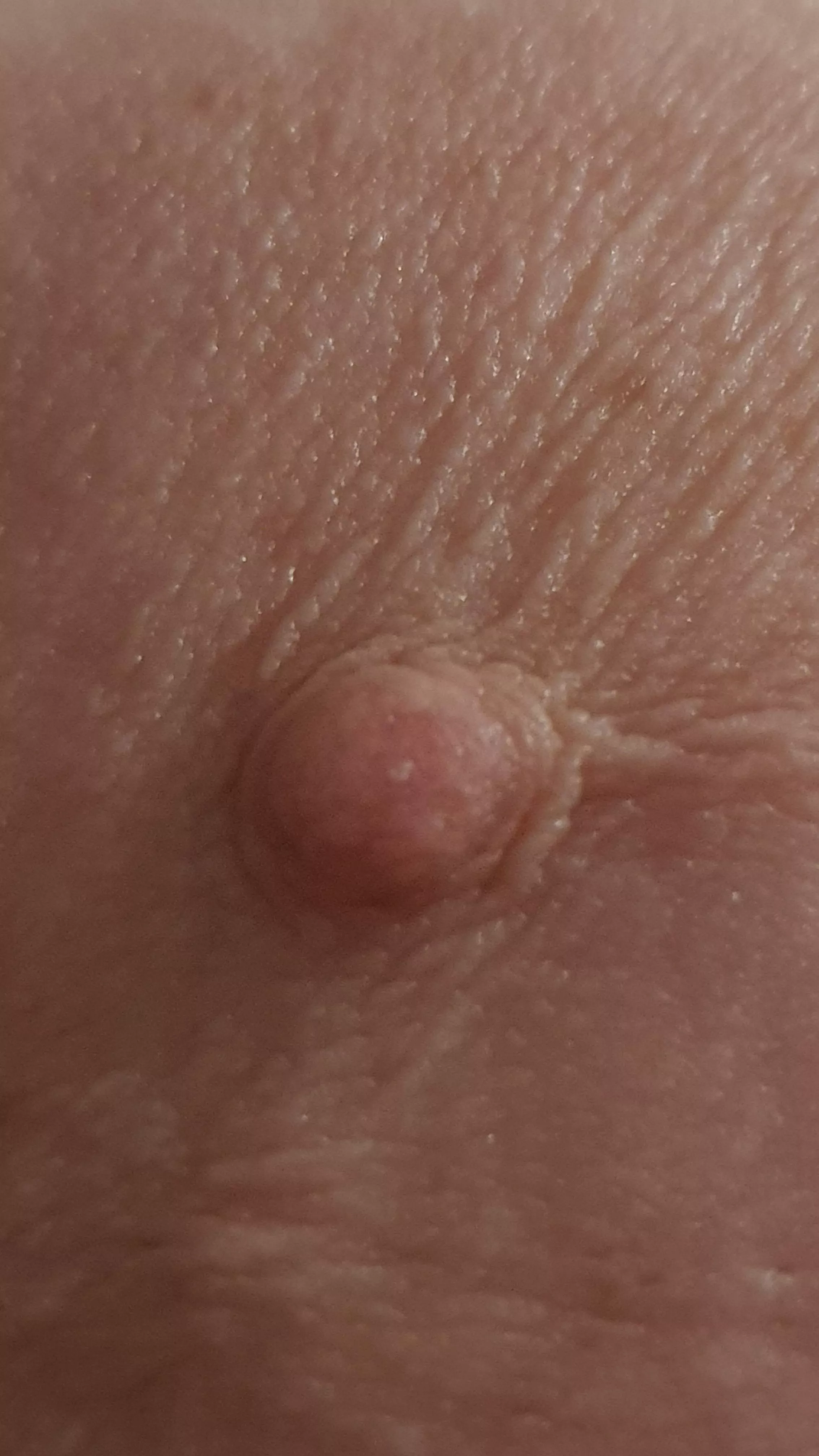 Just my little nipple [F]25