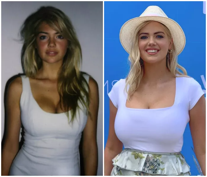 Kate Upton from 18 to post pregnancy