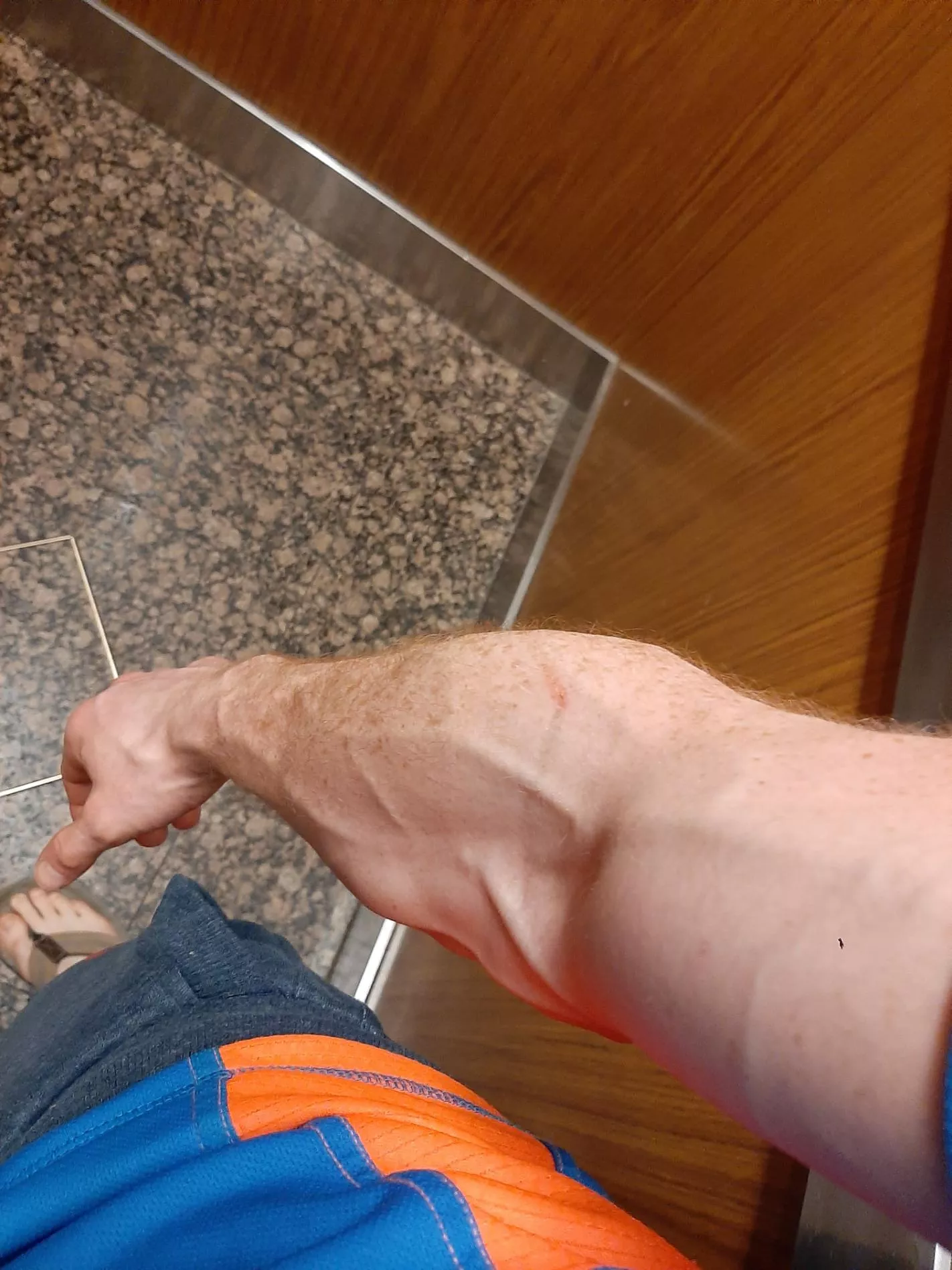 Laundry day. VEINS!