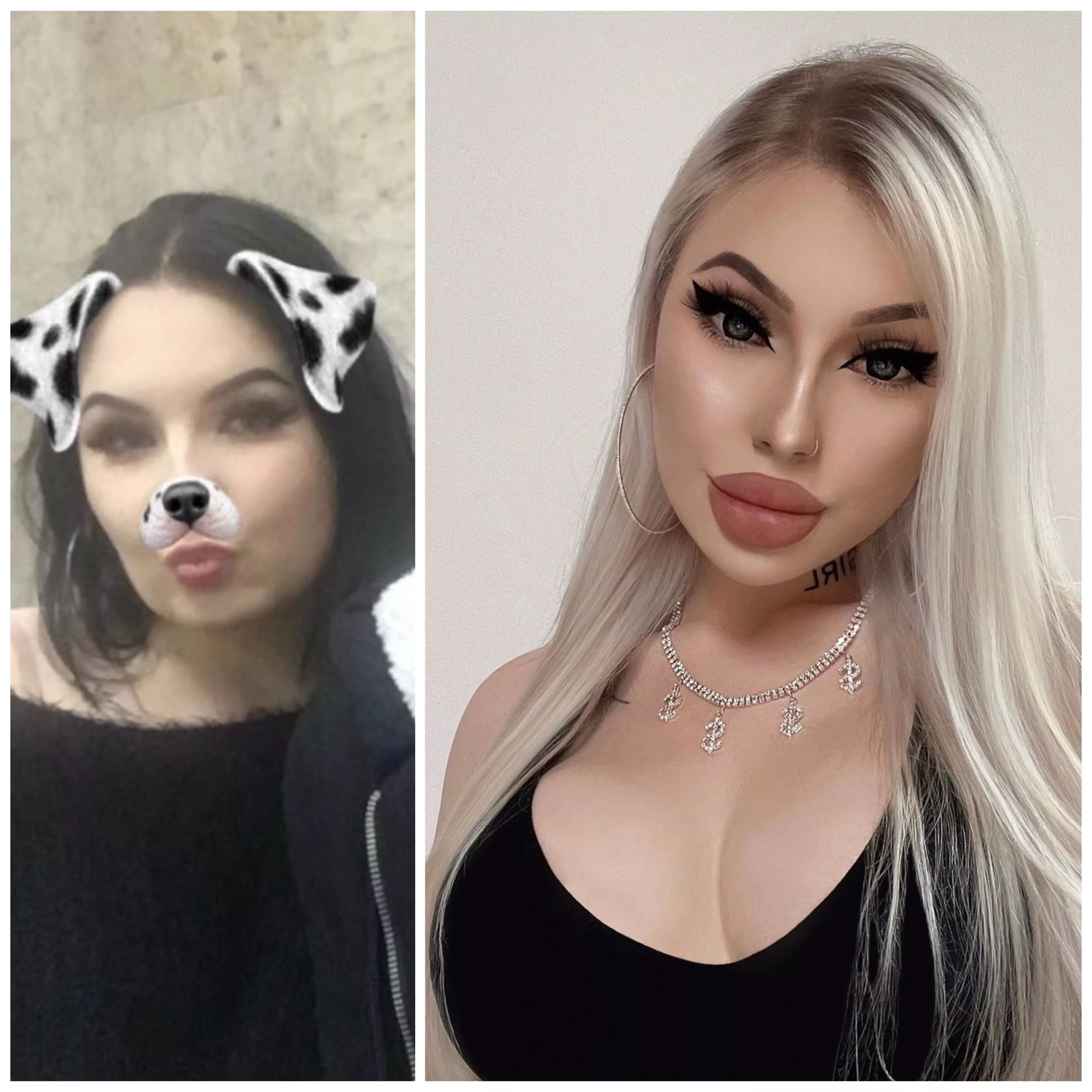 me after fillers and boobs augumentation😈🔥perfect doll🤪