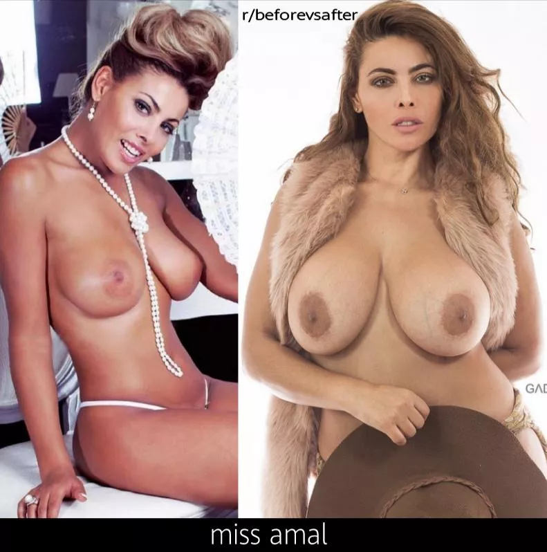 Miss Amal before and after pregnancy