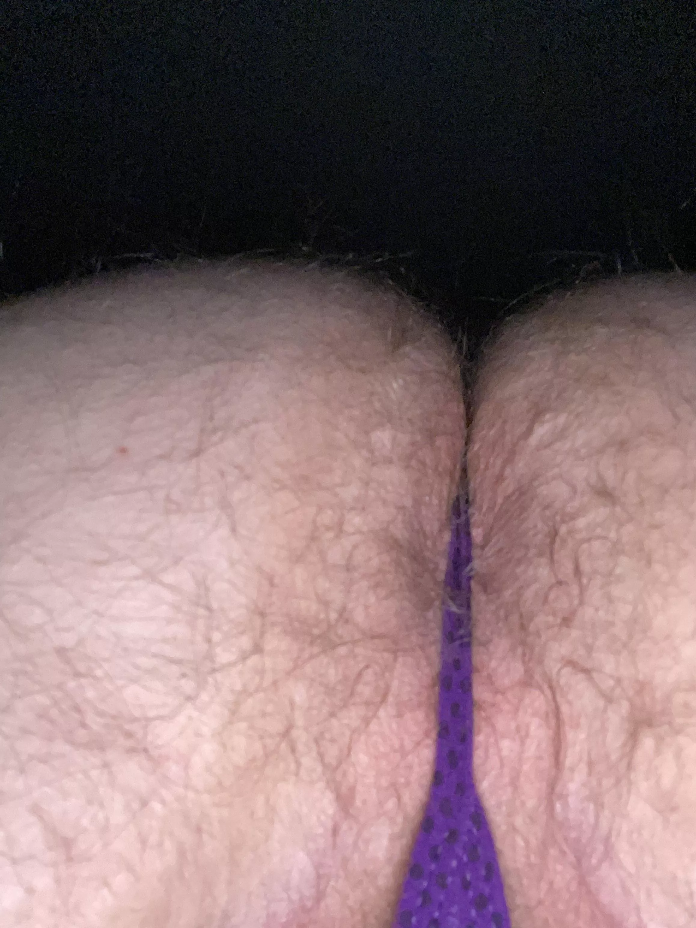 [M]ostly skin…