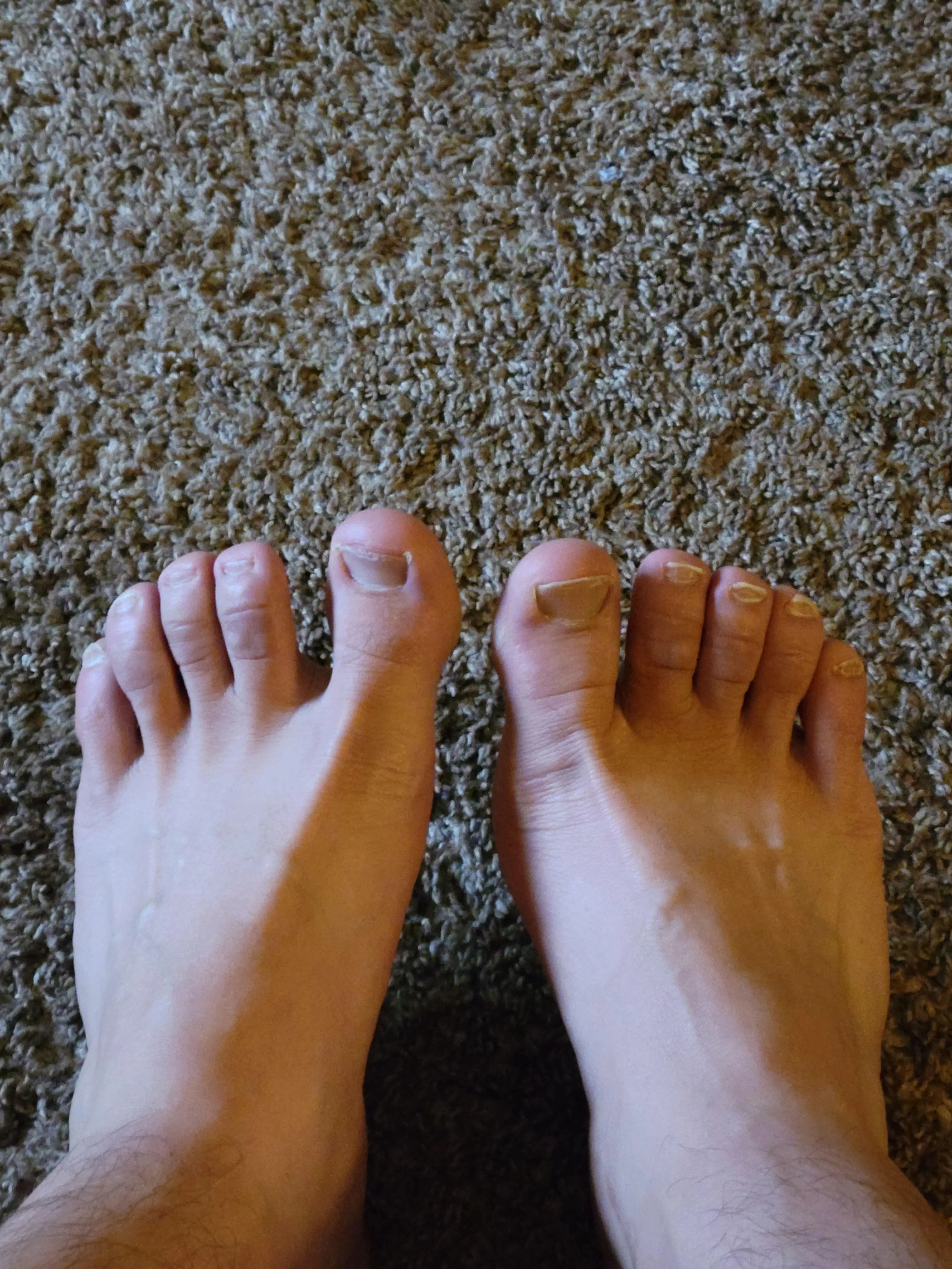 My 2nd ever post. Wanna know what ppl think? Always liked my toes. Hope you do too!